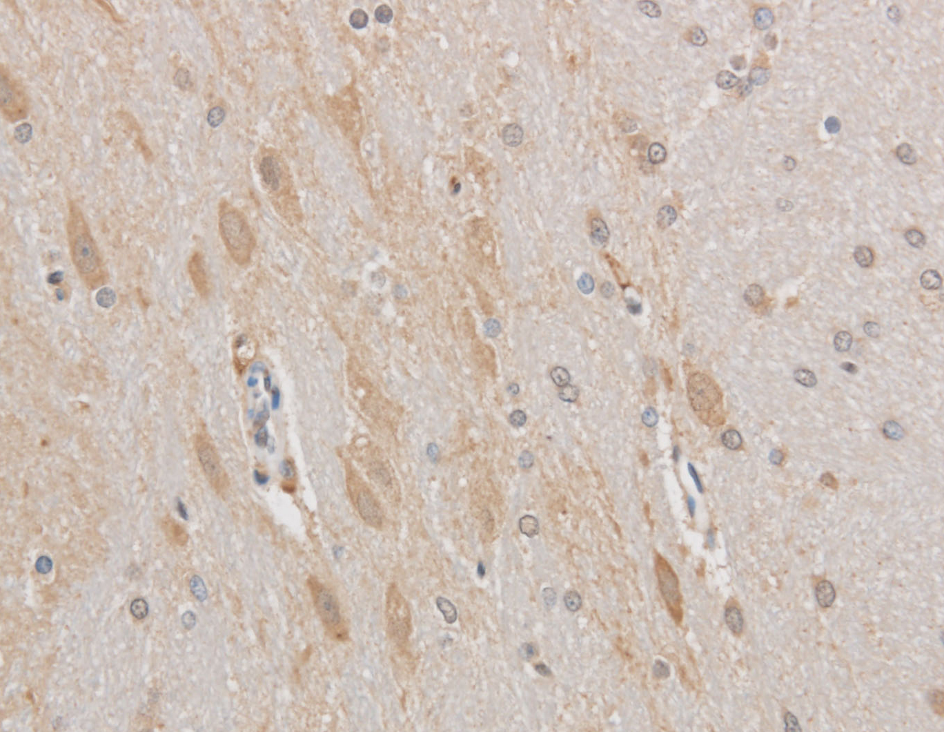 Immunohistochemistry of paraffin-embedded Mouse brain using MAP2 Polyclonal Antibody at dilution of 1:50