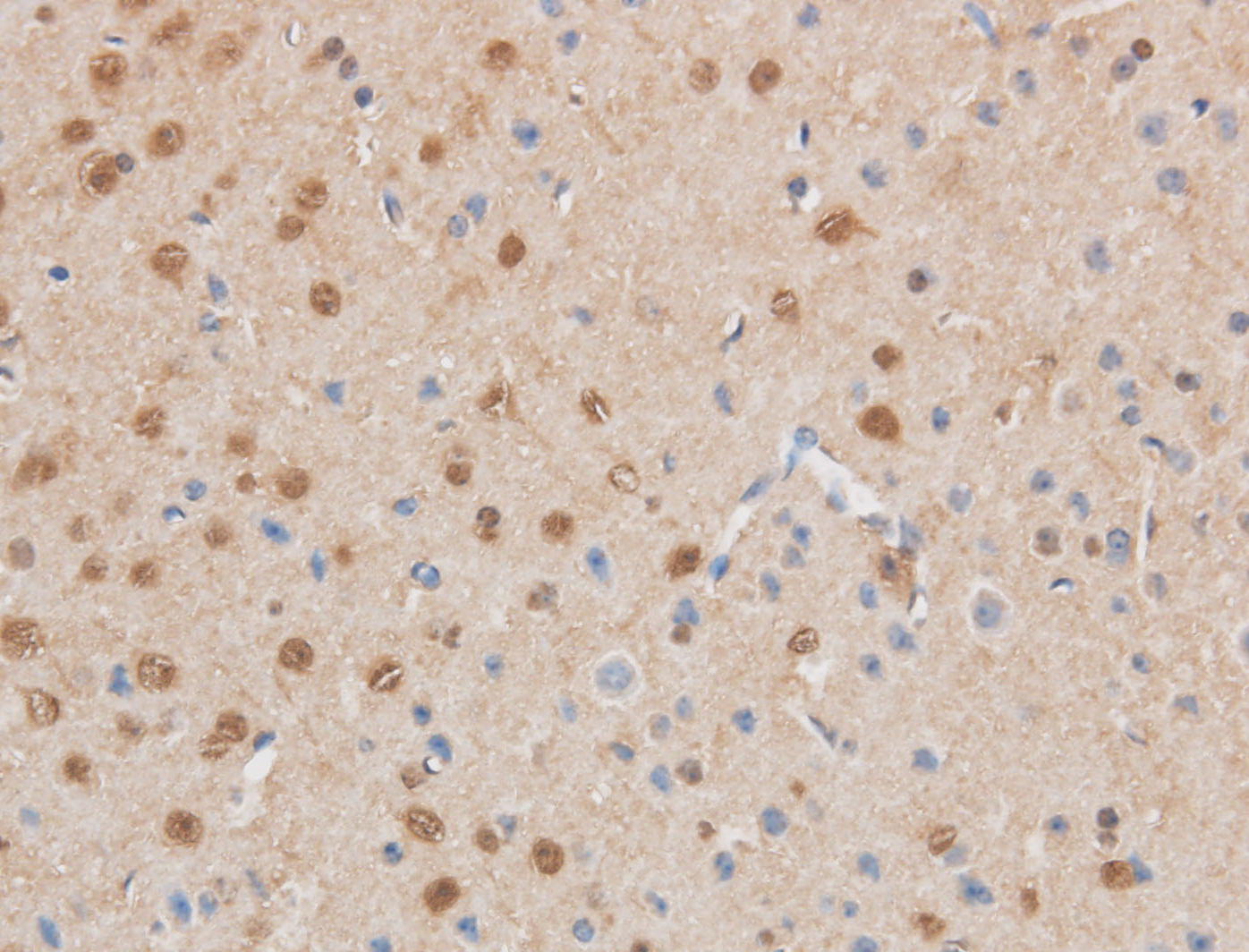 Immunohistochemistry of paraffin-embedded Mouse brain using MAP2K6 Polyclonal Antibody at dilution of 1:50