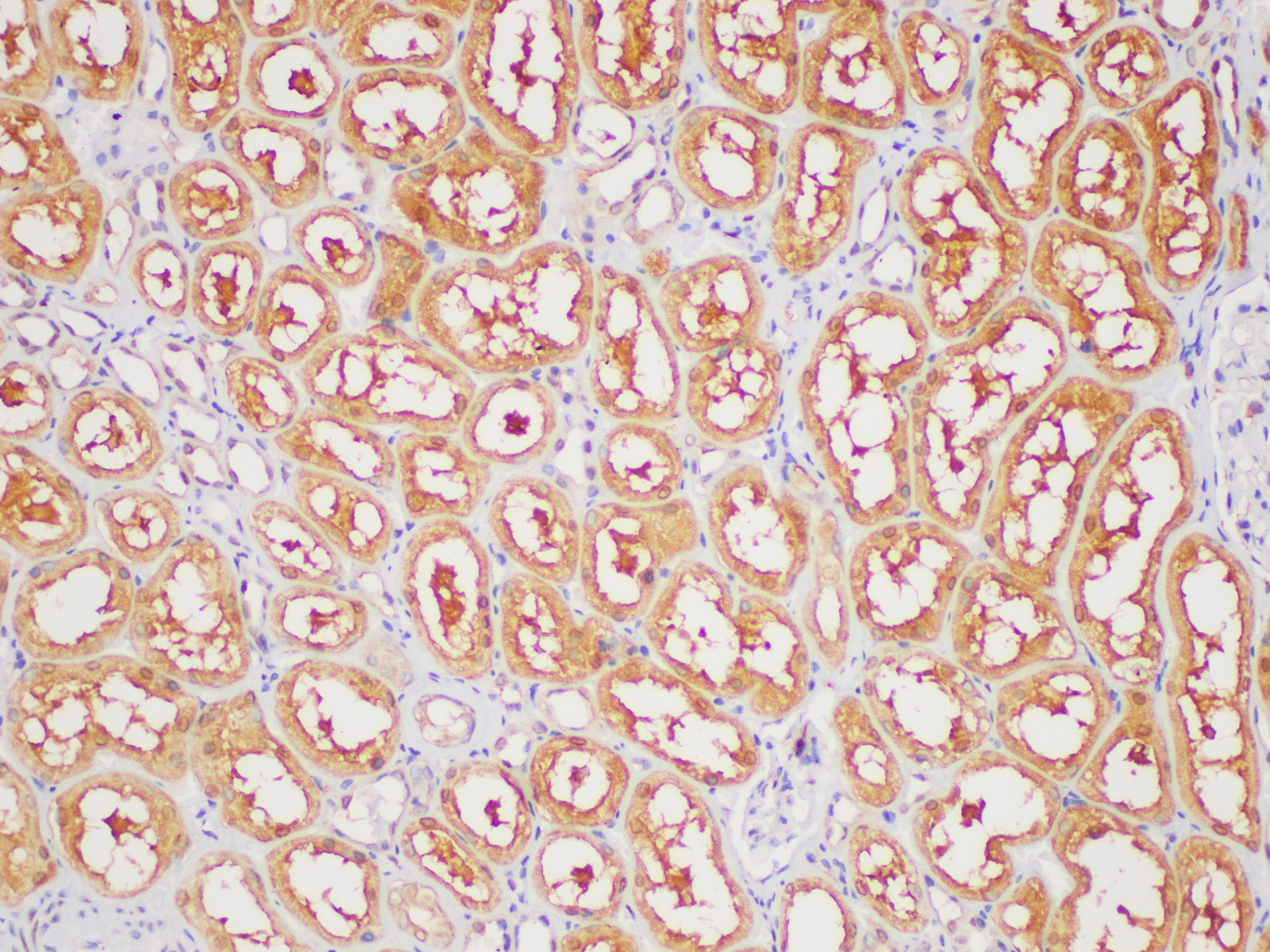 Immunohistochemistry of paraffin-embedded Human kidney using GAPDH Polyclonal Antibody at dilution of 1:400