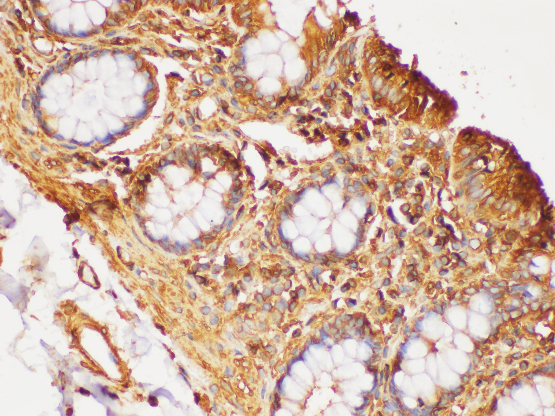 Immunohistochemistry of paraffin-embedded Human colon using beta actin Polyclonal Antibody at dilution of 1:200