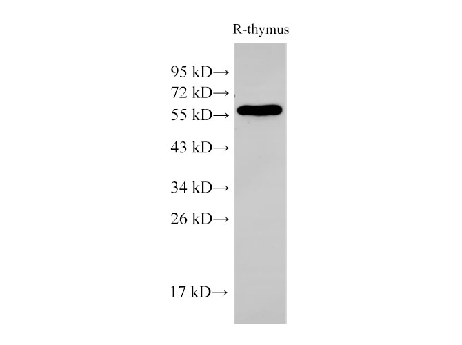 Western Blot analysis of Rat thymus cells  using PDCD4 Polyclonal Antibody at dilution of 1:500