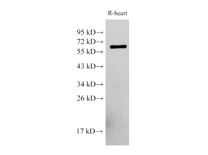 Western Blot analysis of Rat heart cells  using PDCD4 Polyclonal Antibody at dilution of 1:500