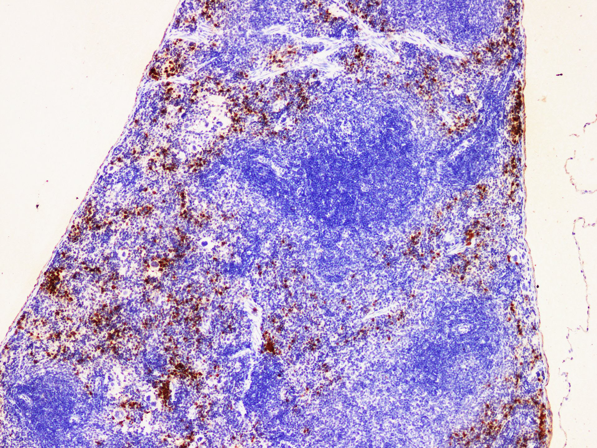 Immunohistochemistry of paraffin-embedded Mouse spleen using S100A9 Polyclonal Antibody at dilution of 1:200(100×)