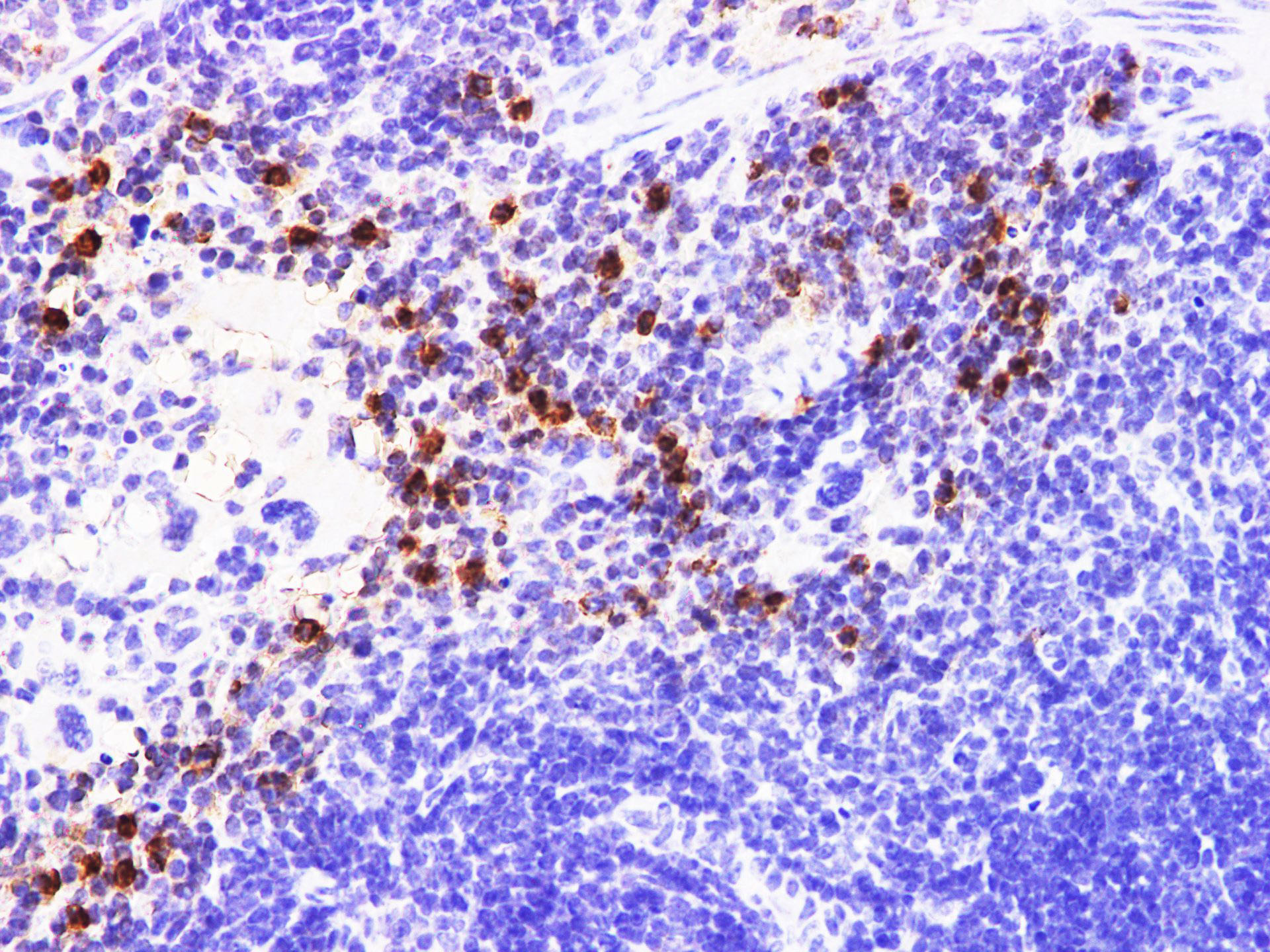 Immunohistochemistry of paraffin-embedded Mouse spleen  using S100A9 Polyclonal Antibody at dilution of 1:200(400×)