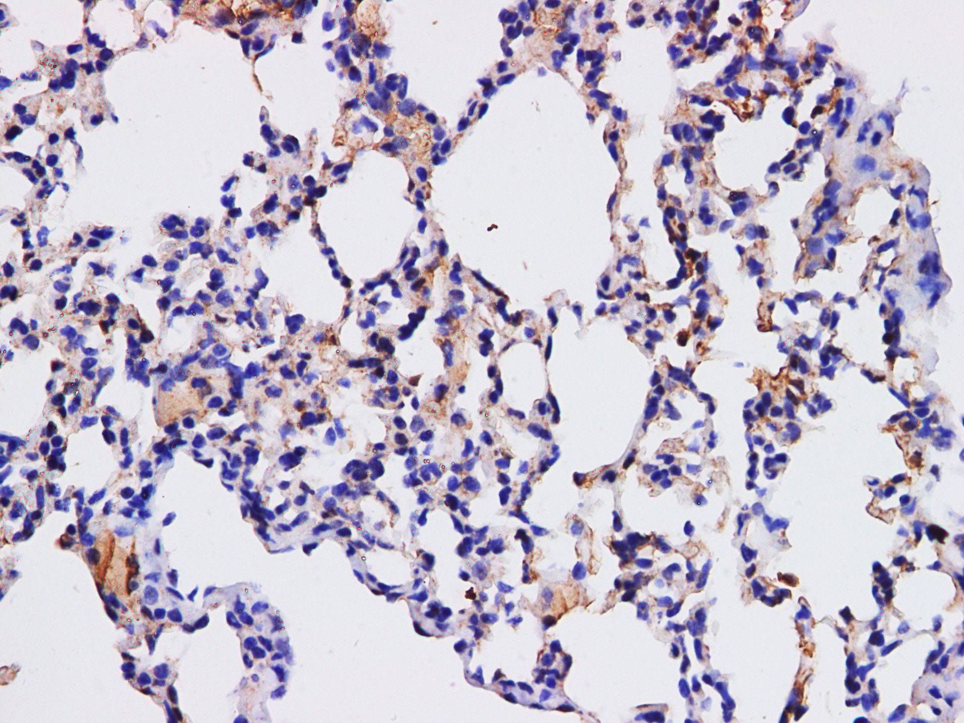 Immunohistochemistry of paraffin-embedded Mouse lung using HPGD Polyclonal Antibody at dilution of 1:200