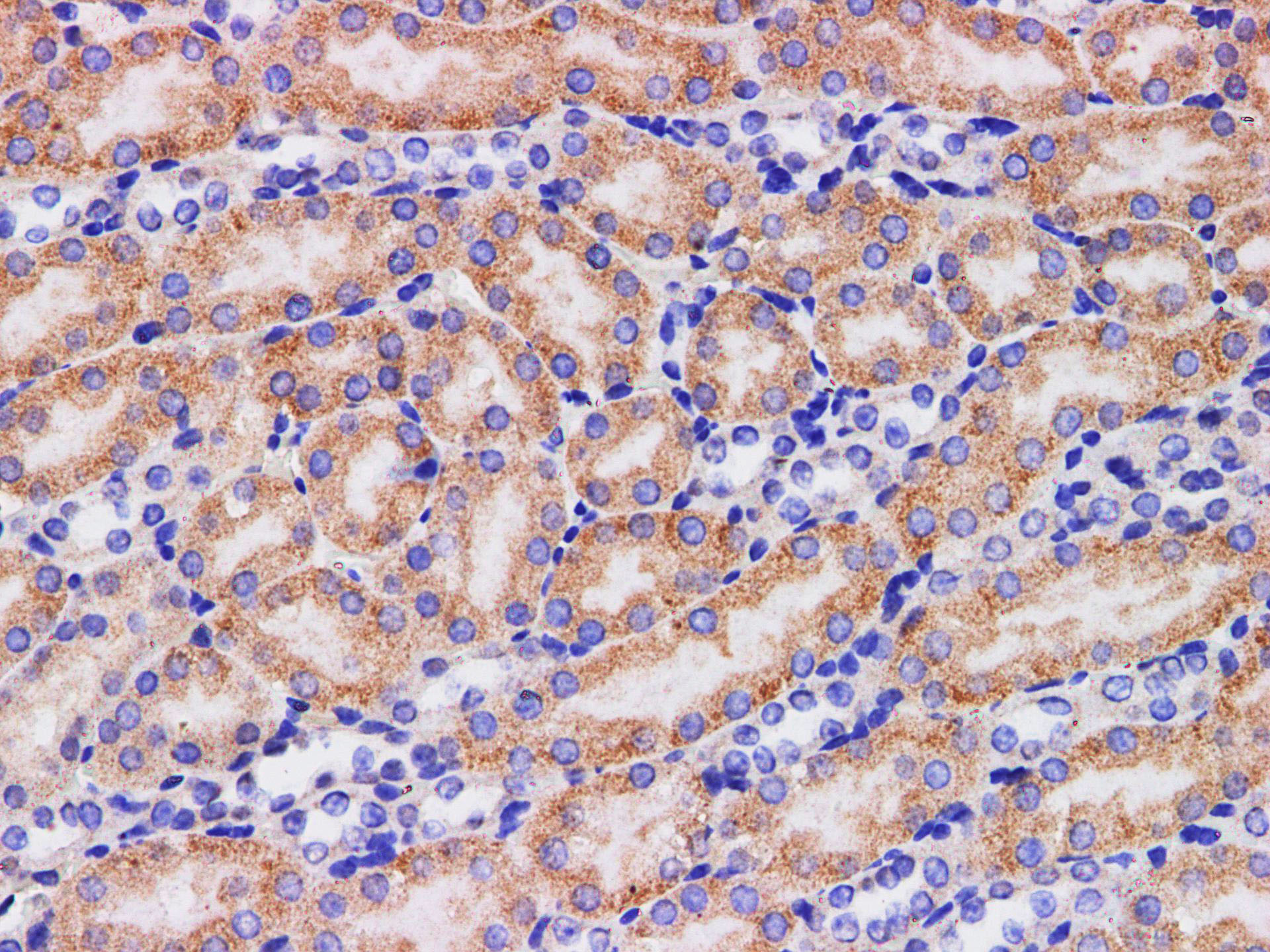 Immunohistochemistry of paraffin-embedded Mouse kidney  using HPGD Polyclonal Antibody at dilution of 1:200