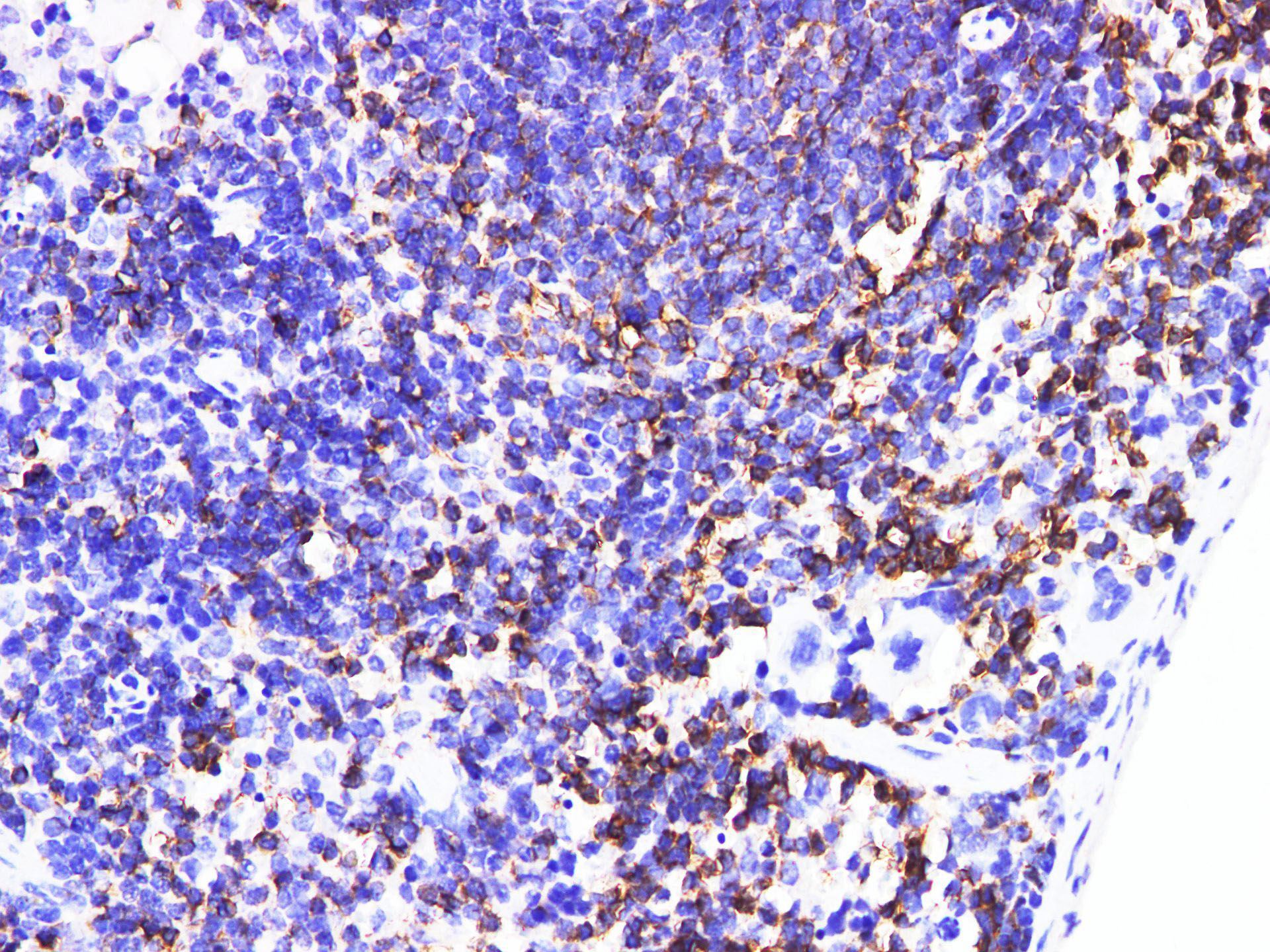 Immunohistochemistry of paraffin-embedded Mouse spleen  using IL6R Polyclonal Antibody at dilution of 1:200