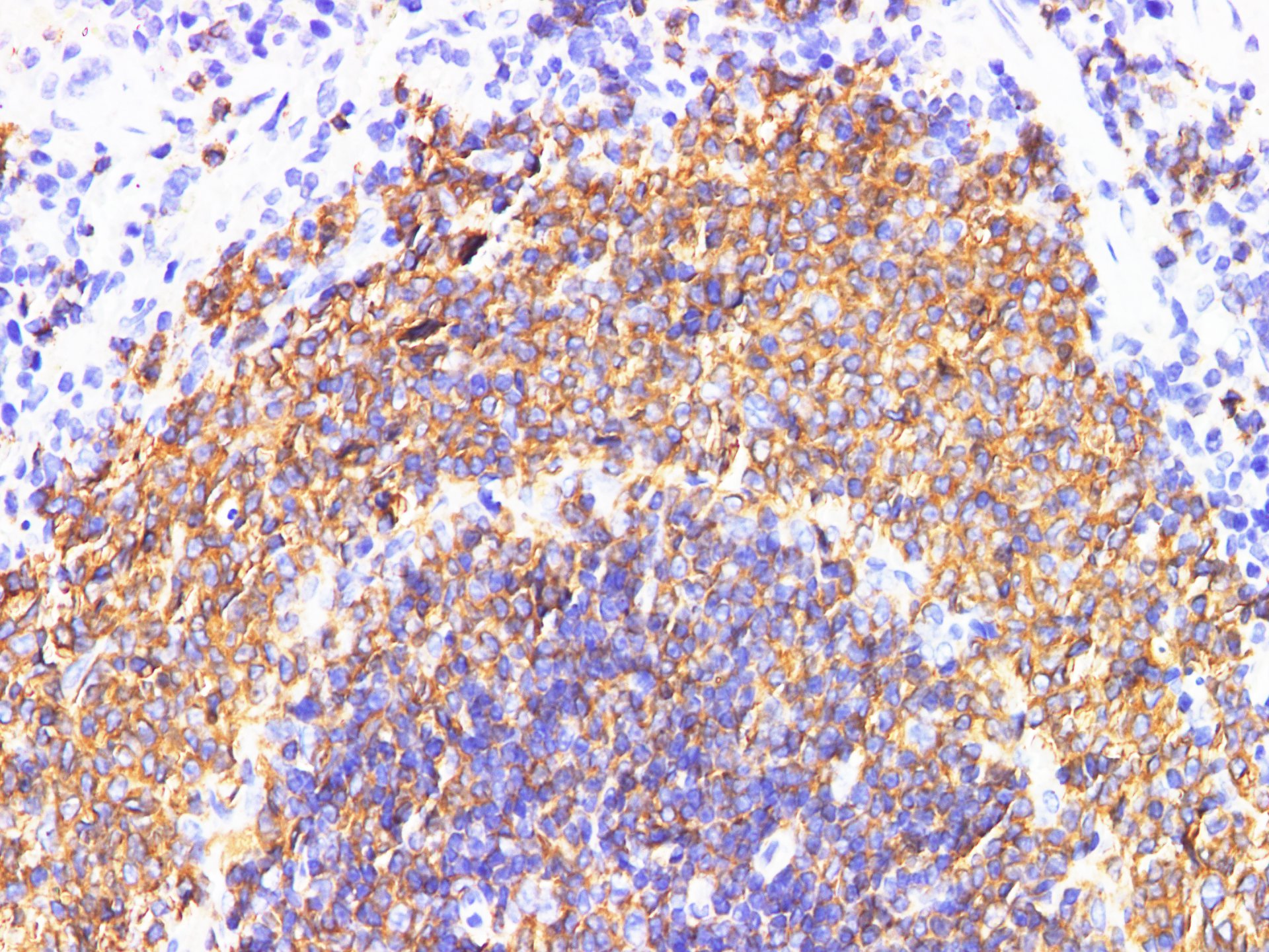 Immunohistochemistry of paraffin-embedded Rat spleen  using IL6R Polyclonal Antibody at dilution of 1:200