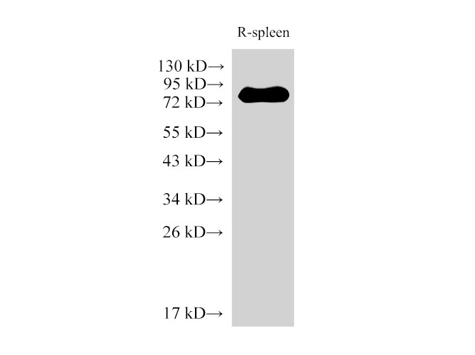 Western Blot analysis of Rat spleen  using IL6R Polyclonal Antibody at dilution of 1:2000