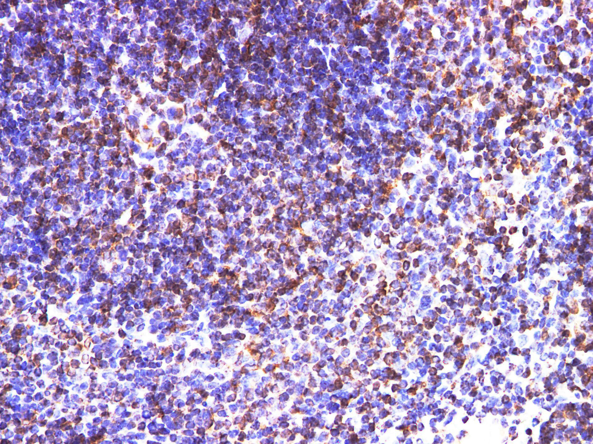 Immunohistochemistry of paraffin-embedded Mouse spleen  using CD74 Polyclonal Antibody at dilution of 1:200