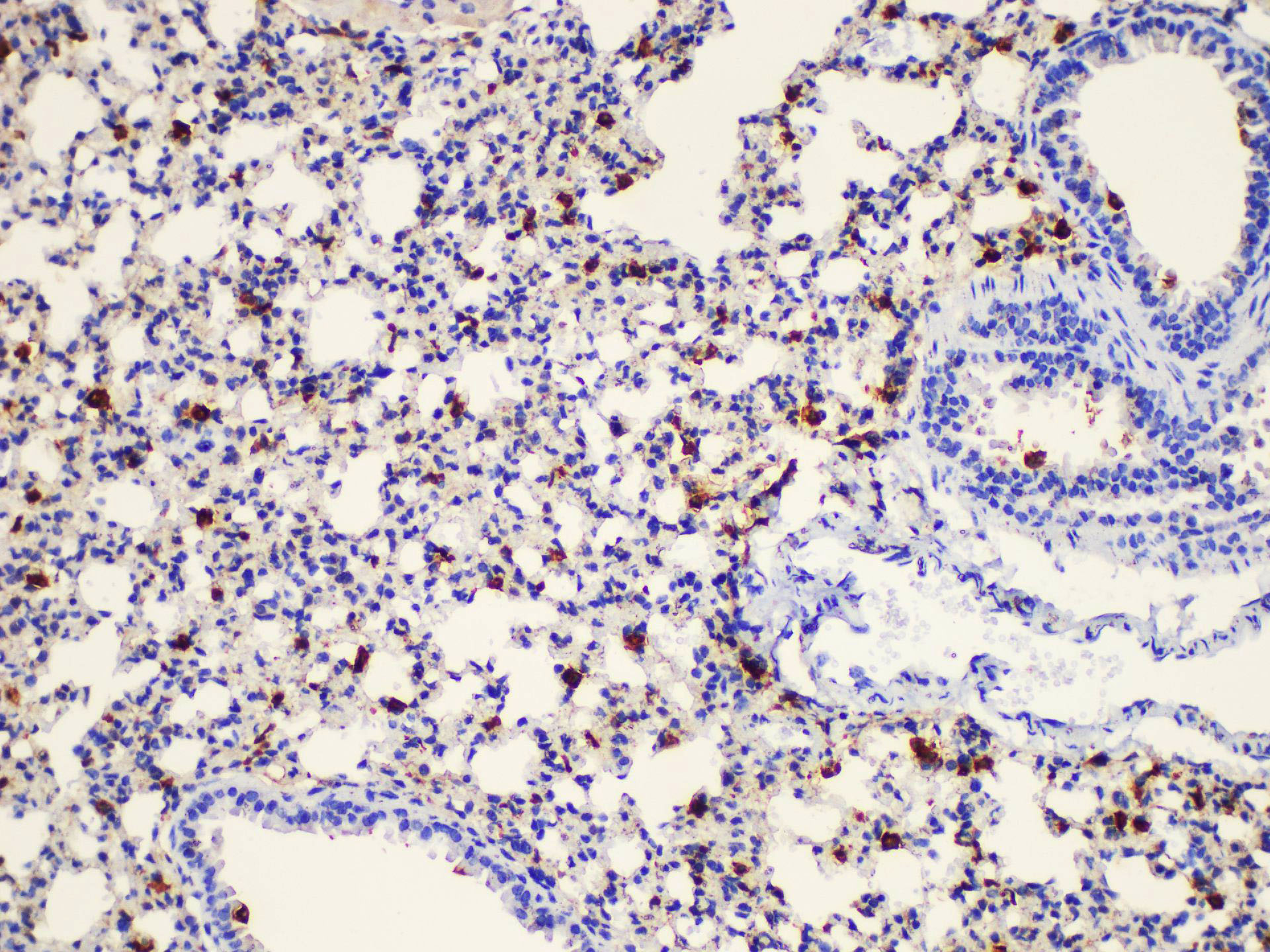 Immunohistochemistry of paraffin-embedded Mouse lung using LGALS3 Polycloanl Antibody at dilution of 1:200