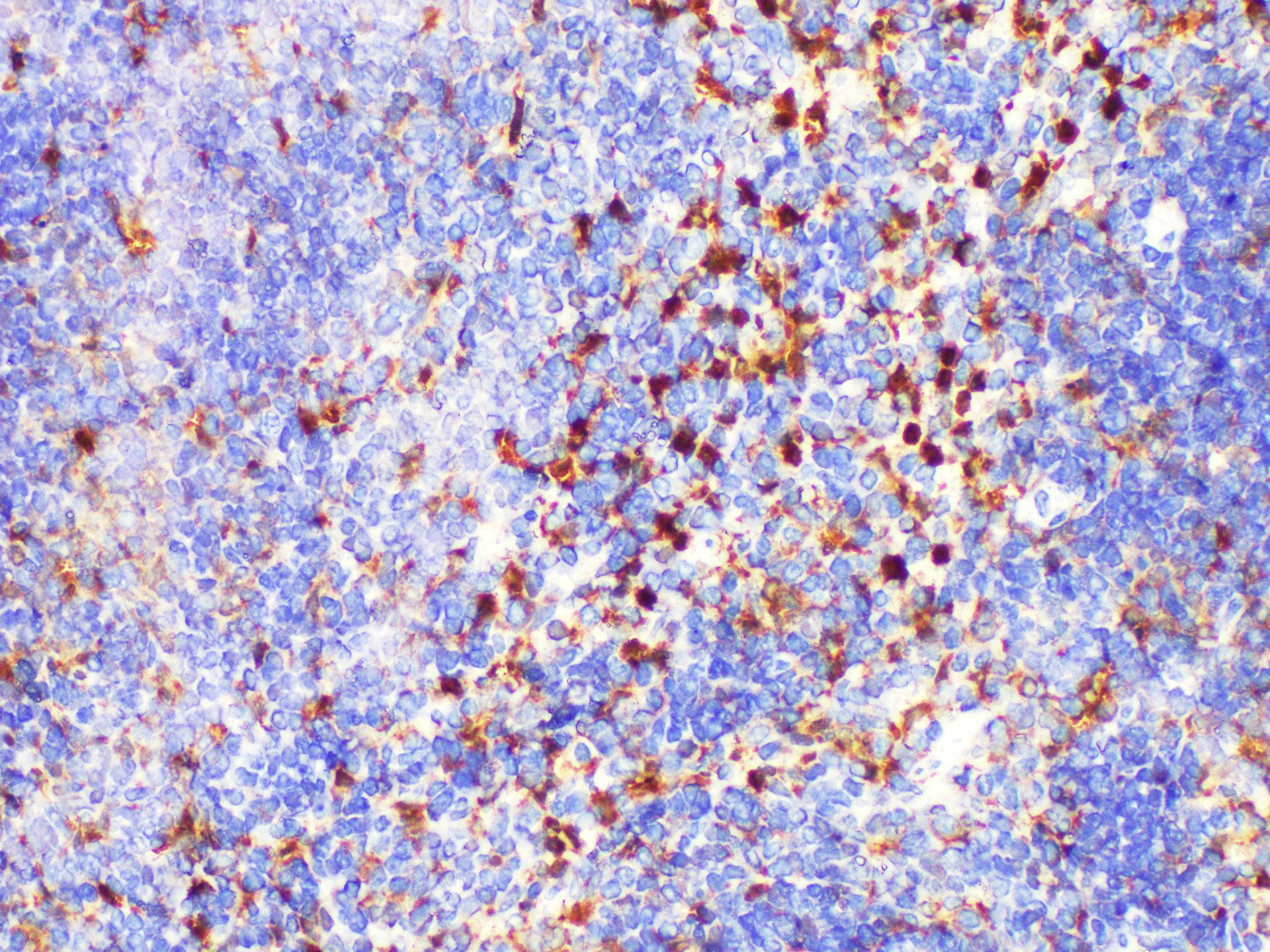 Immunohistochemistry of paraffin-embedded Mouse spleen using LGALS3 Polycloanl Antibody at dilution of 1:200