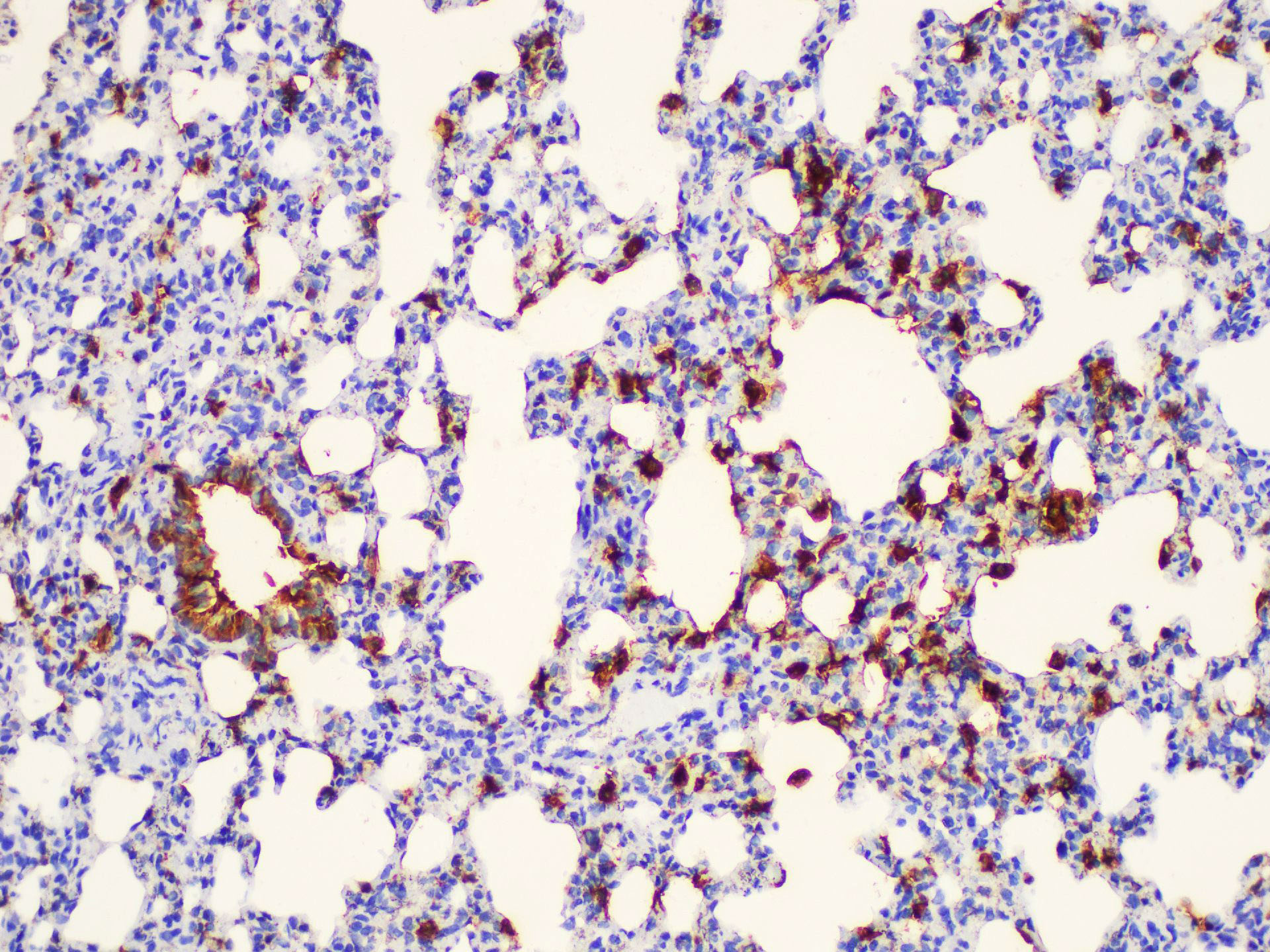 Immunohistochemistry of paraffin-embedded Rat lung using LGALS3 Polycloanl Antibody at dilution of 1:200