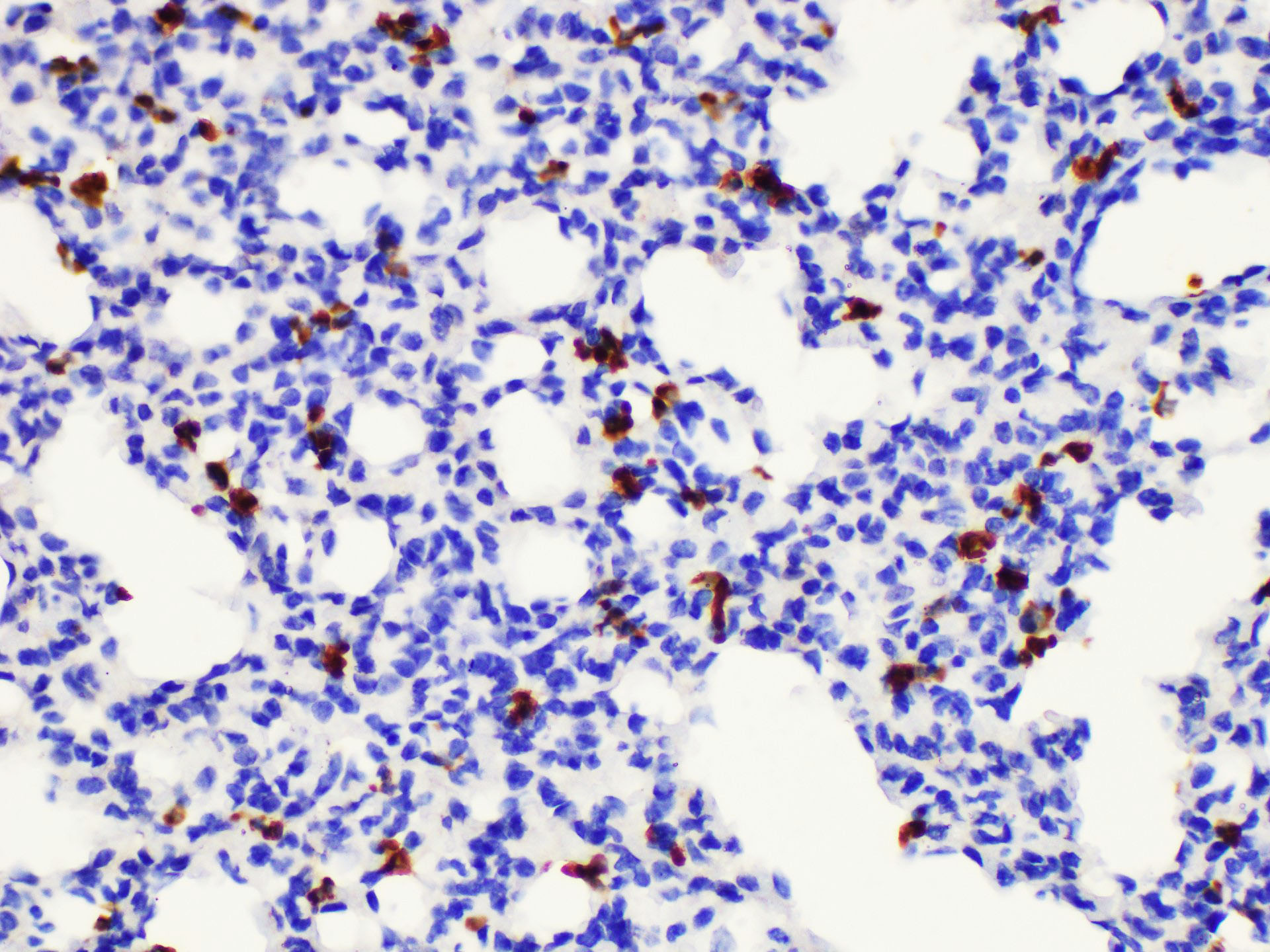 Immunohistochemistry of paraffin-embedded Mouse lung using S100a8 Polycloanl Antibody at dilution of 1:200