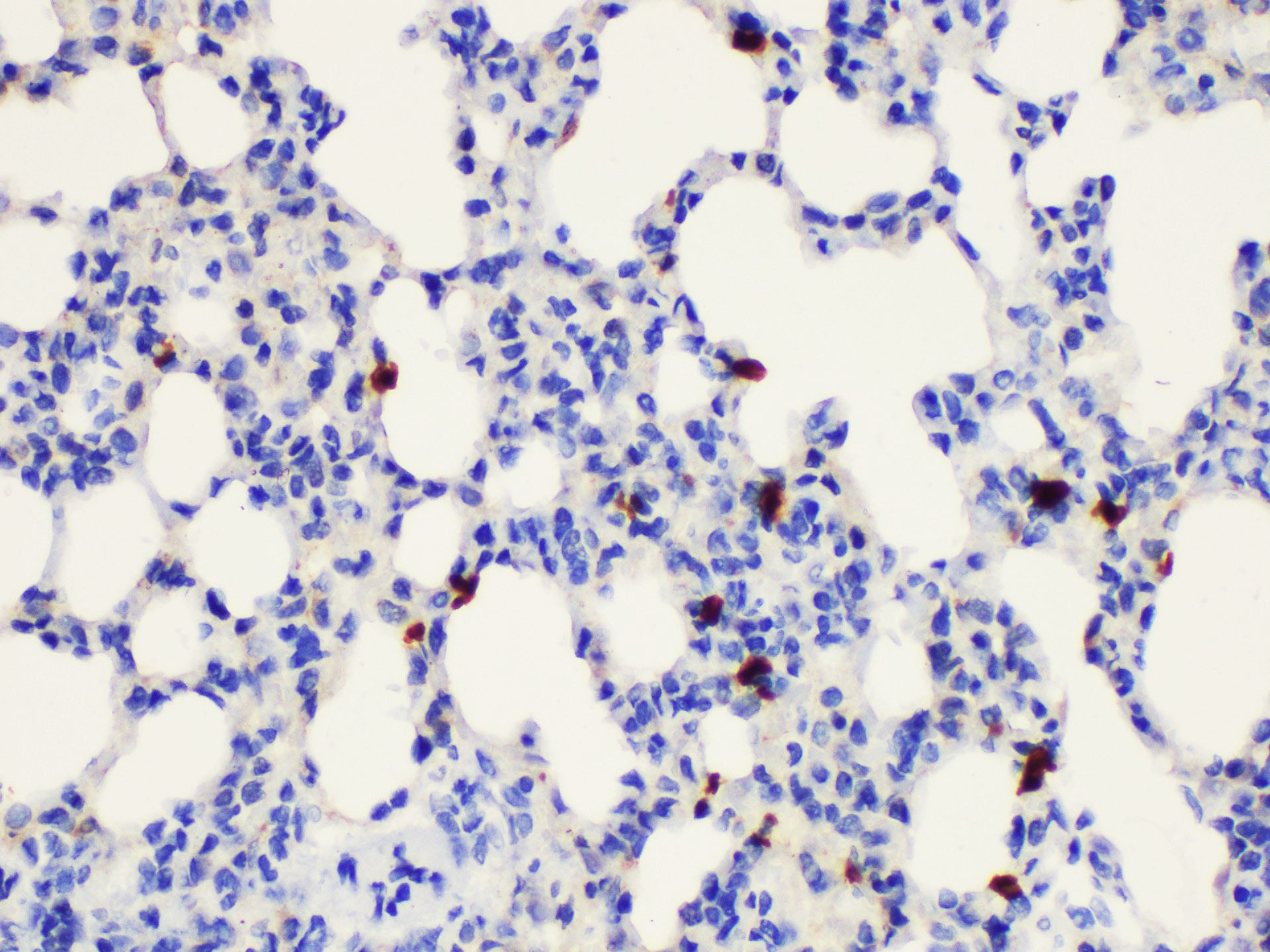 Immunohistochemistry of paraffin-embedded Rat lung using S100a8 Polycloanl Antibody at dilution of 1:200