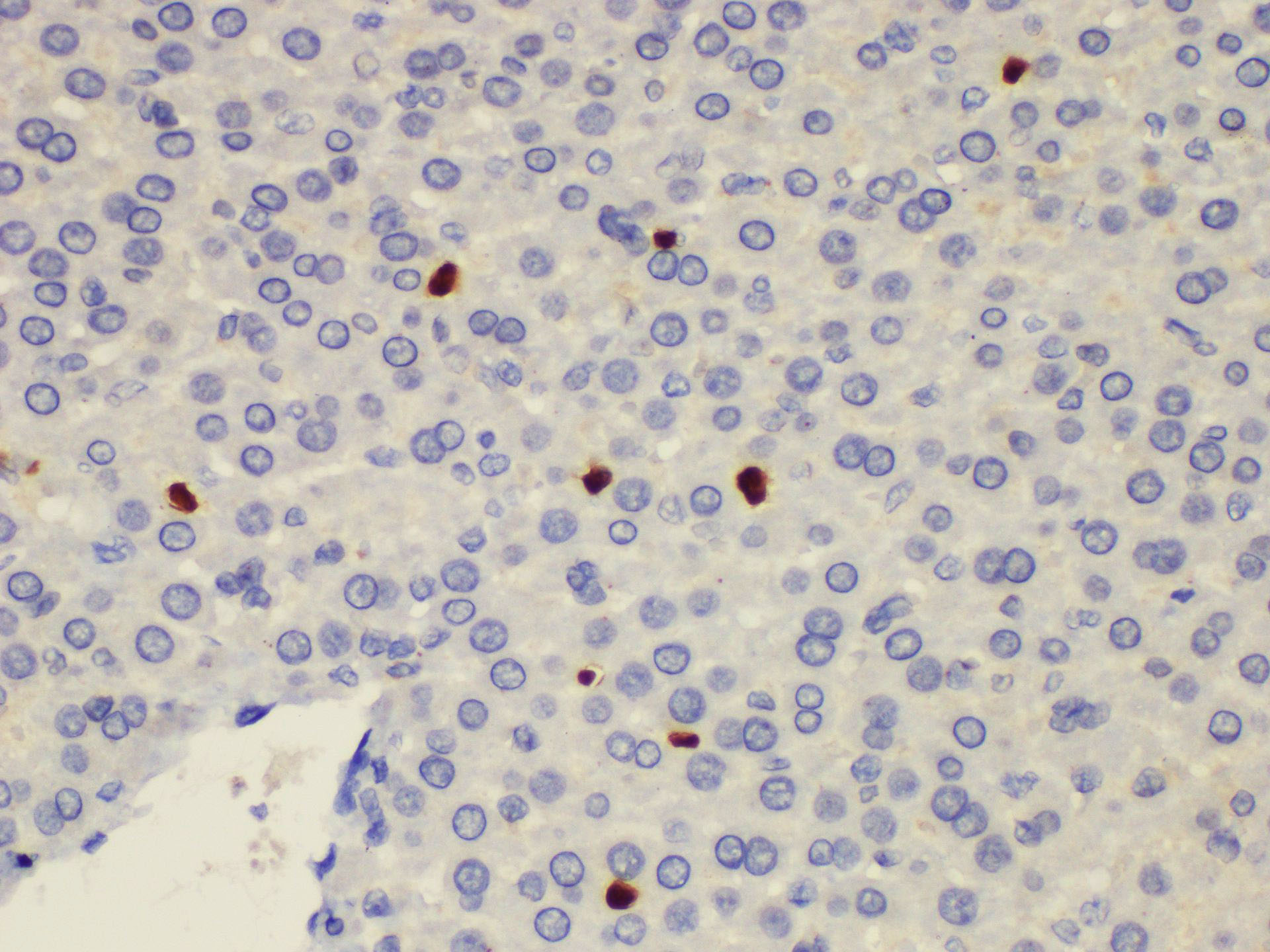 Immunohistochemistry of paraffin-embedded Rat liver using S100a8 Polycloanl Antibody at dilution of 1:200