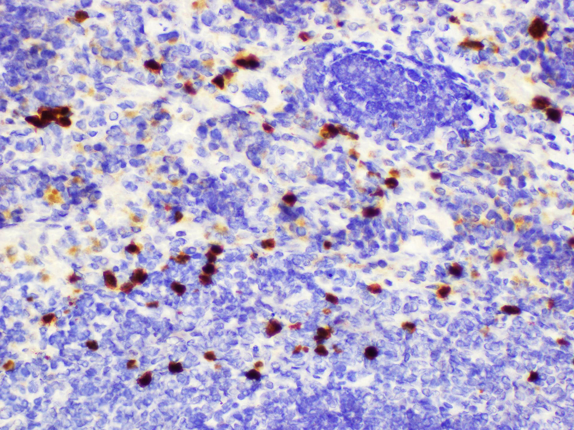 Immunohistochemistry of paraffin-embedded Rat spleen using S100a8 Polycloanl Antibody at dilution of 1:200