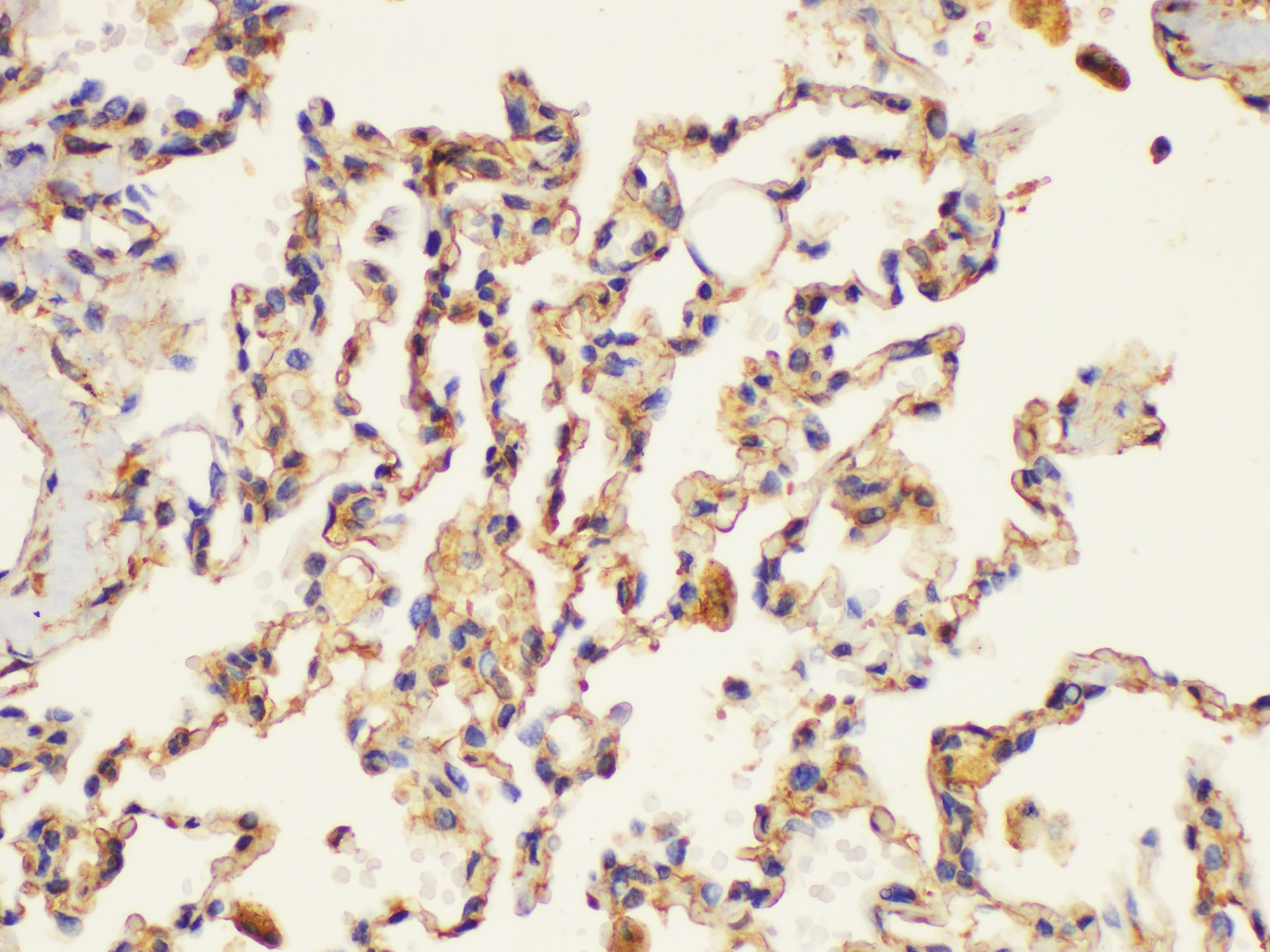 Immunohistochemistry of paraffin-embedded Human lung using PLAUR Ployclonal Antibody at dilution of 1:200.