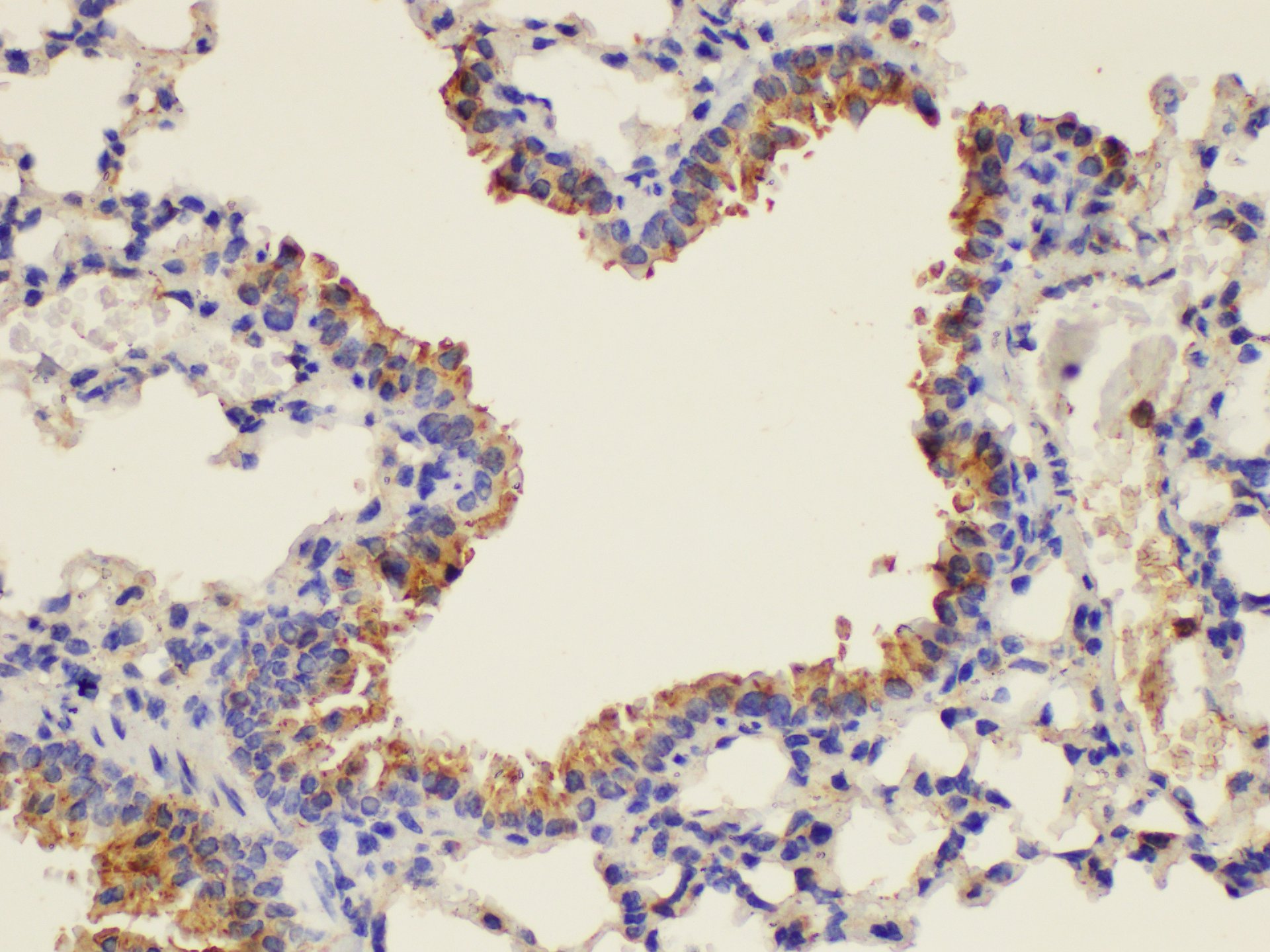 Immunohistochemistry of paraffin-embedded Mouse lung using PLAUR Ployclonal Antibody at dilution of 1:200.