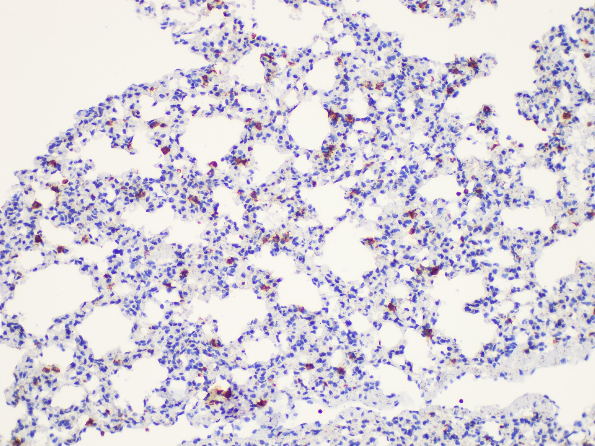 Immunohistochemistry of paraffin-embedded Mouse lung using Galectin 3 Ployclonal Antibody at dilution of 1:50.