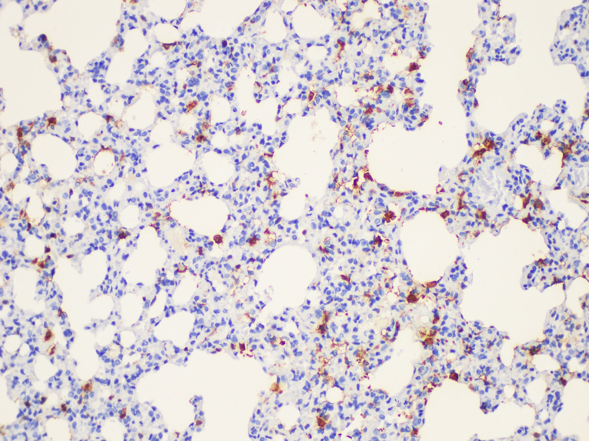 Immunohistochemistry of paraffin-embedded Rat lung using Galectin 3 Ployclonal Antibody at dilution of 1:50.