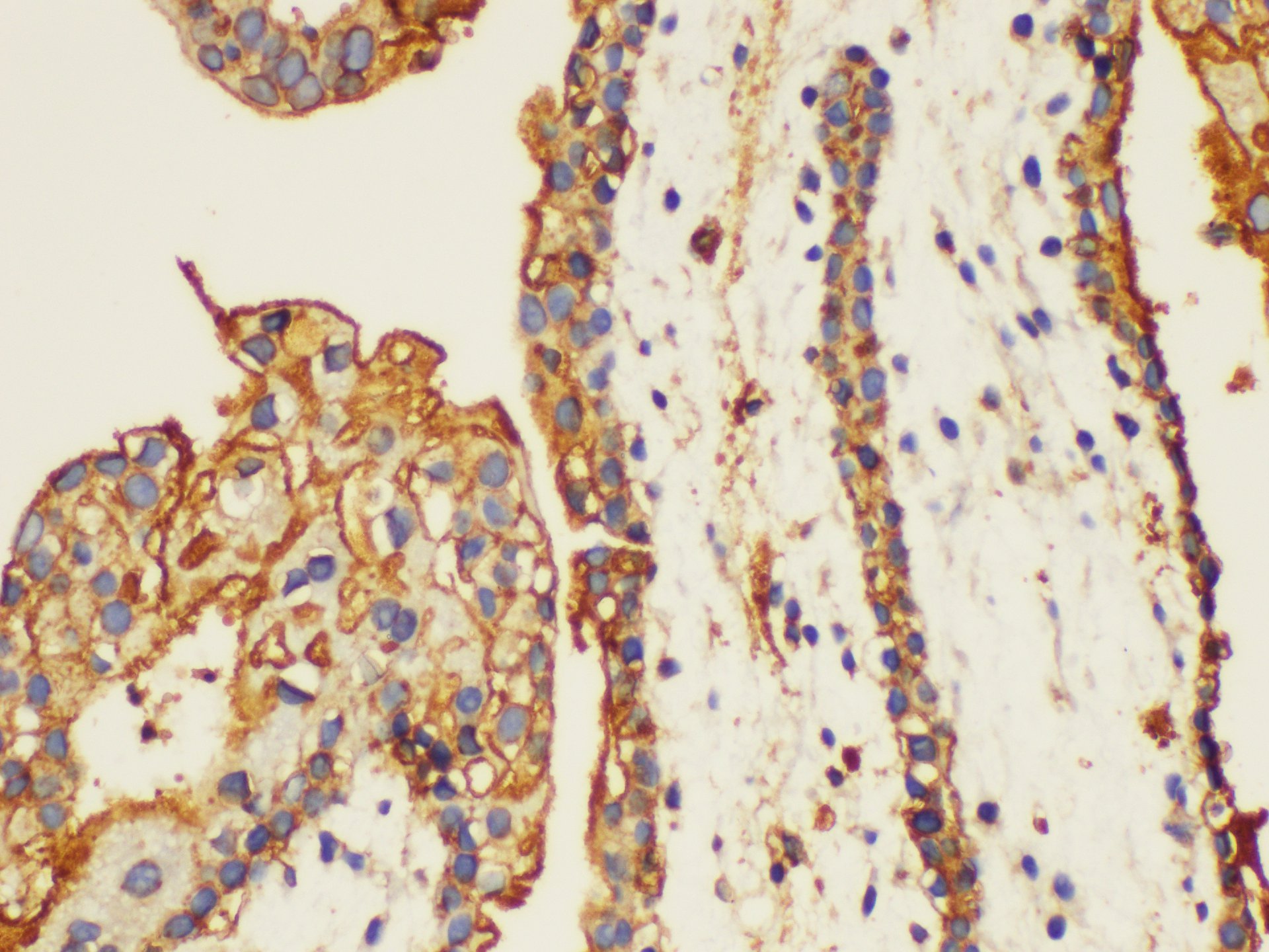 Immunohistochemistry of paraffin-embedded Human placenta using ANXA5 Ployclonal Antibody at dilution of 1:100.