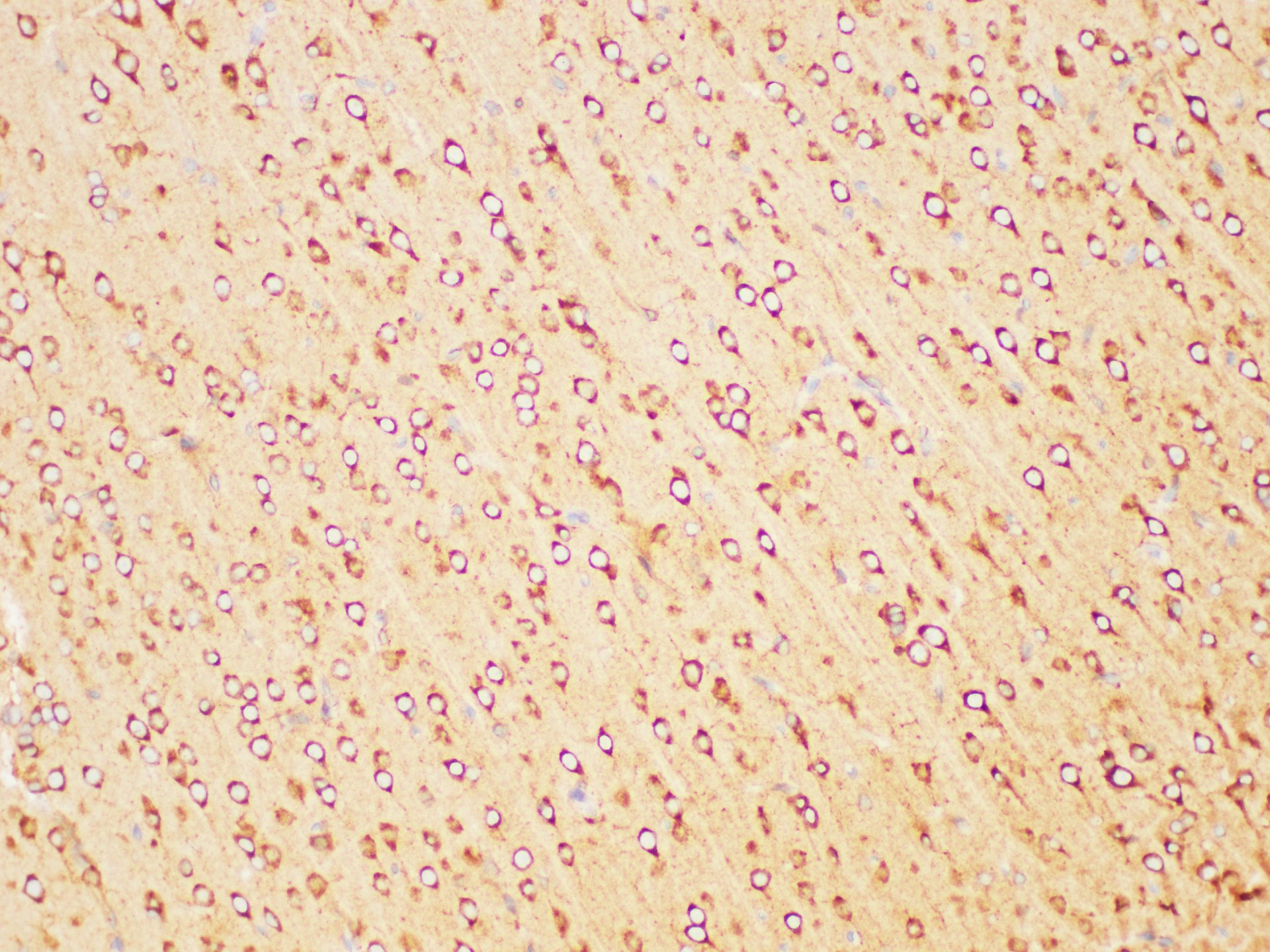 Immunohistochemistry of paraffin-embedded Rat brain using FOLH1 Polycloanl Antibody at dilution of 1:200