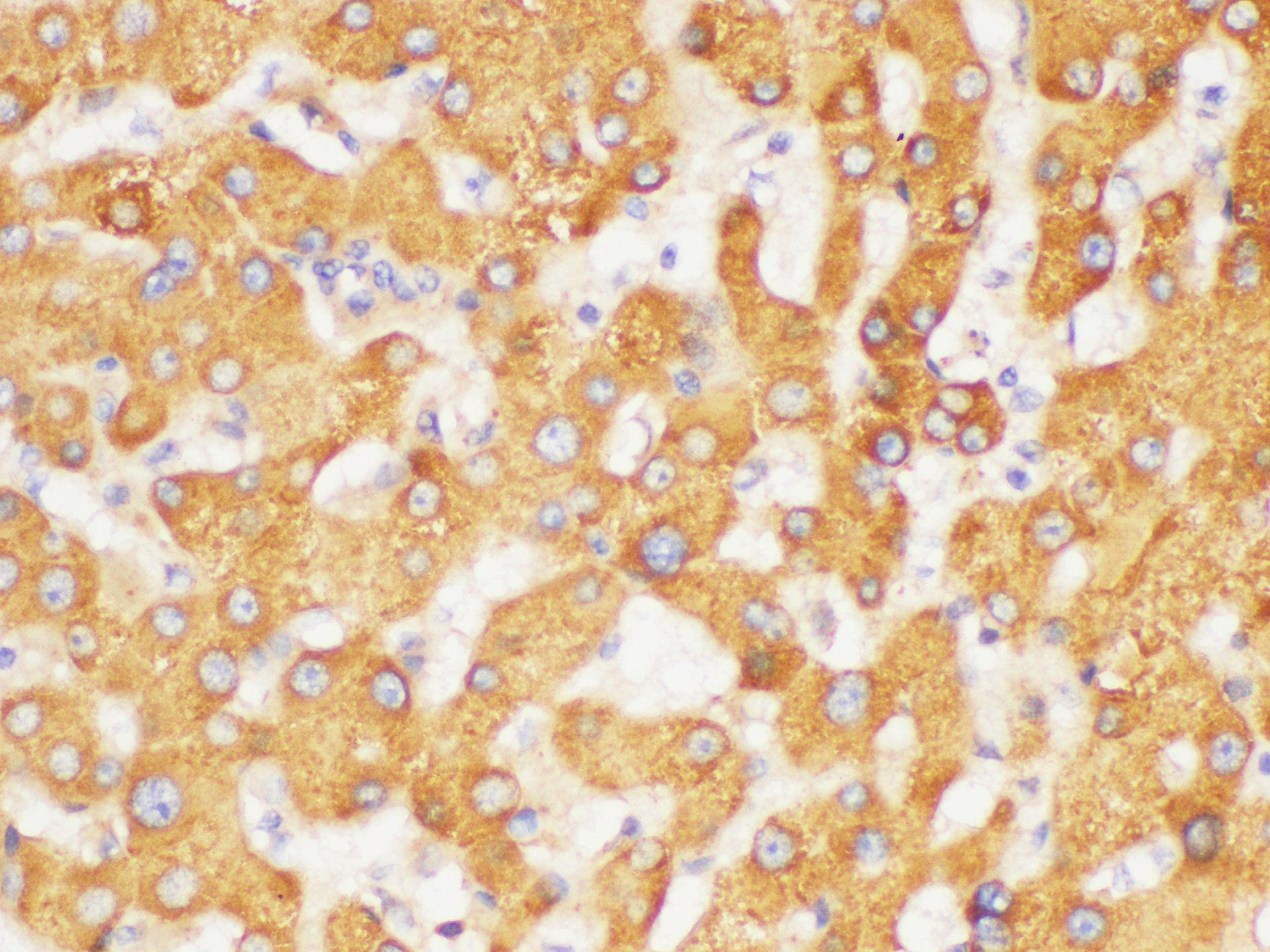 Immunohistochemistry of paraffin-embedded Human liver using FGB Polycloanl Antibody at dilution of 1:200