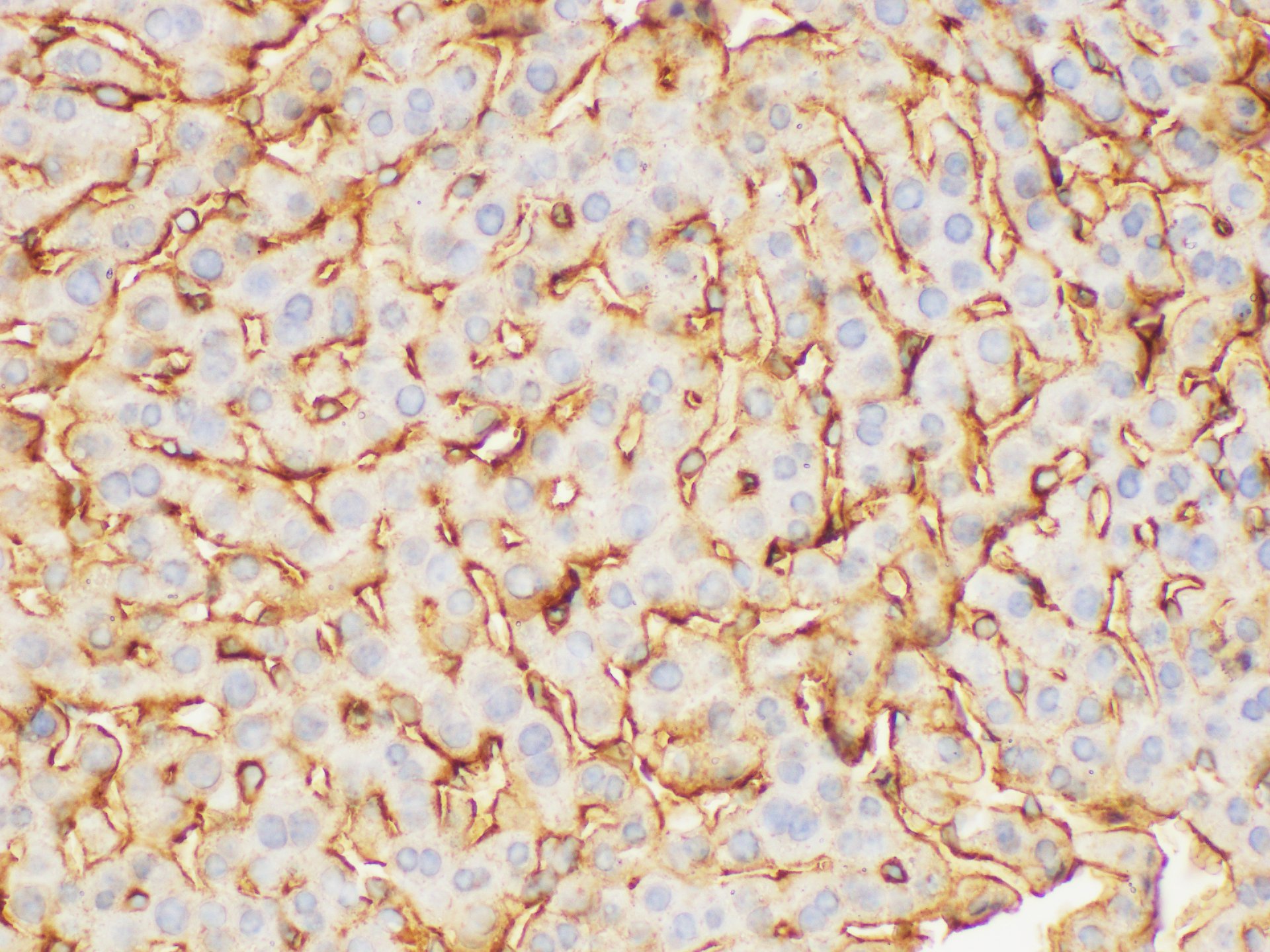 Immunohistochemistry of paraffin-embedded Mouse liver using FGB Polycloanl Antibody at dilution of 1:200