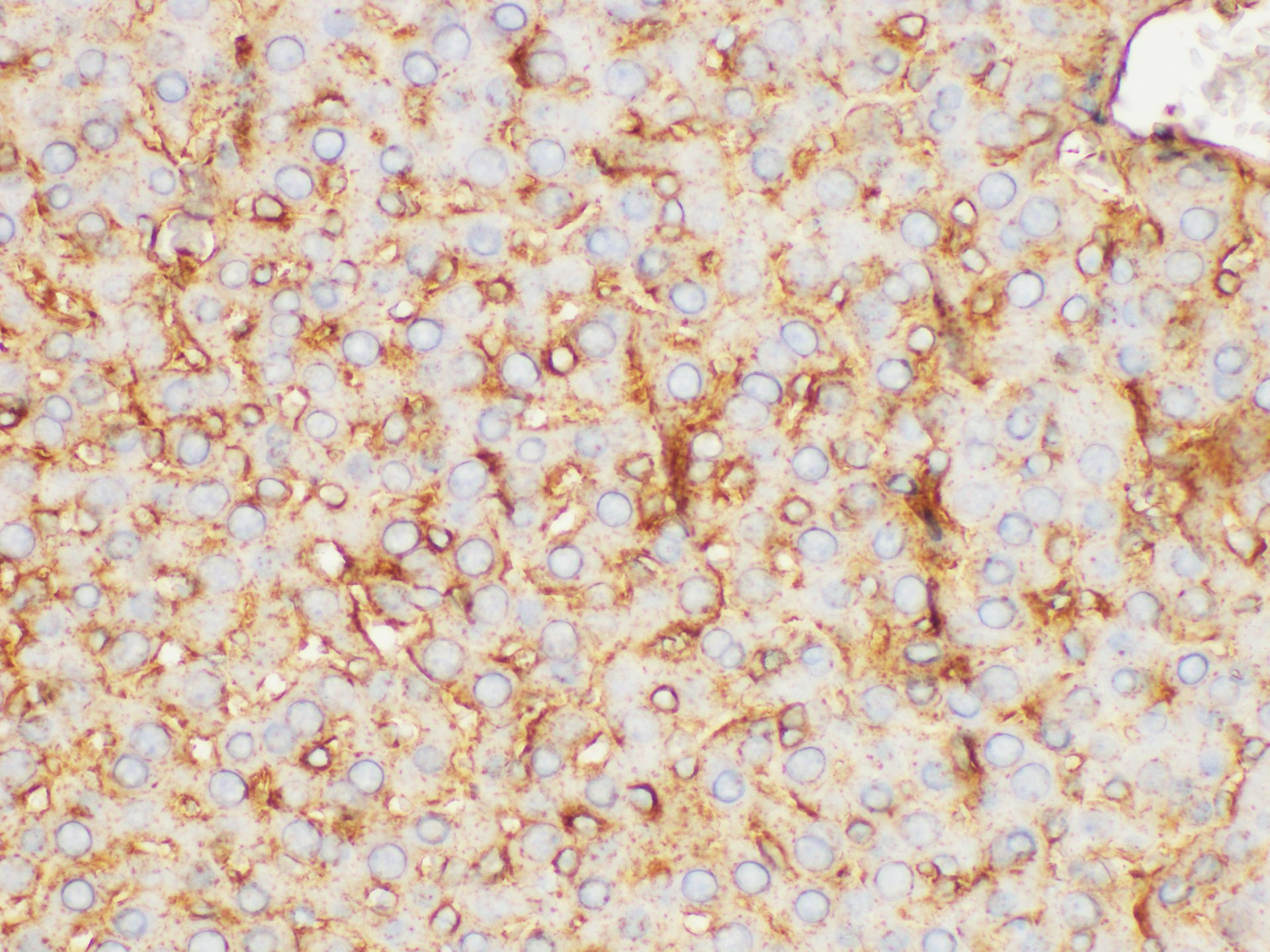 Immunohistochemistry of paraffin-embedded Rat liver using FGB Polycloanl Antibody at dilution of 1:200