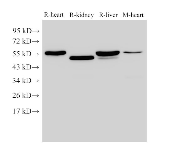 Western Blot analysis of Rat heart, Rat kidney, Rat liver and Mouse heart using FGB Polyclonal Antibody at dilution of 1:4000