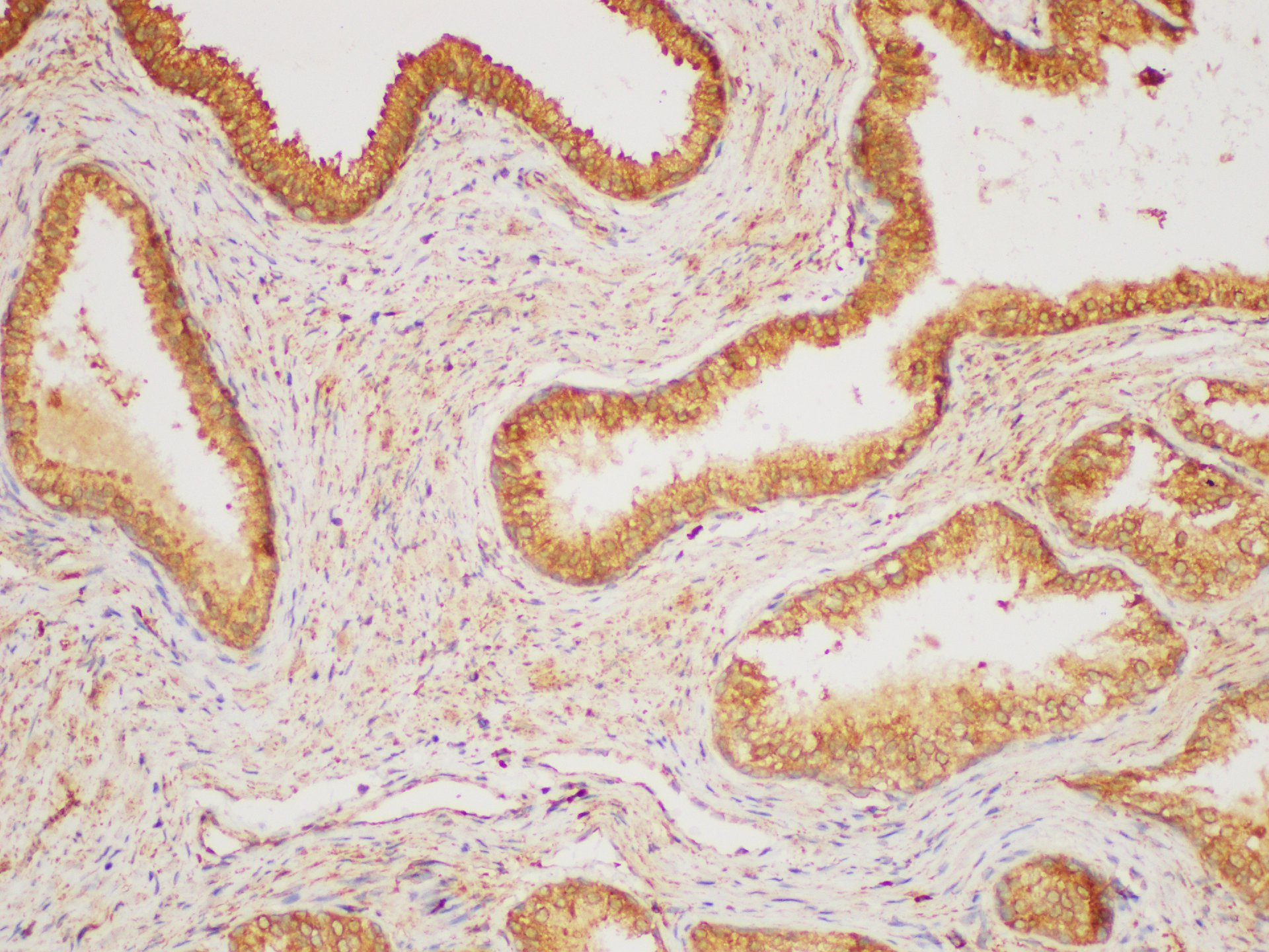 Immunohistochemistry of paraffin-embedded Human prostate gland using HRAS Polycloanl Antibody at dilution of 1:200