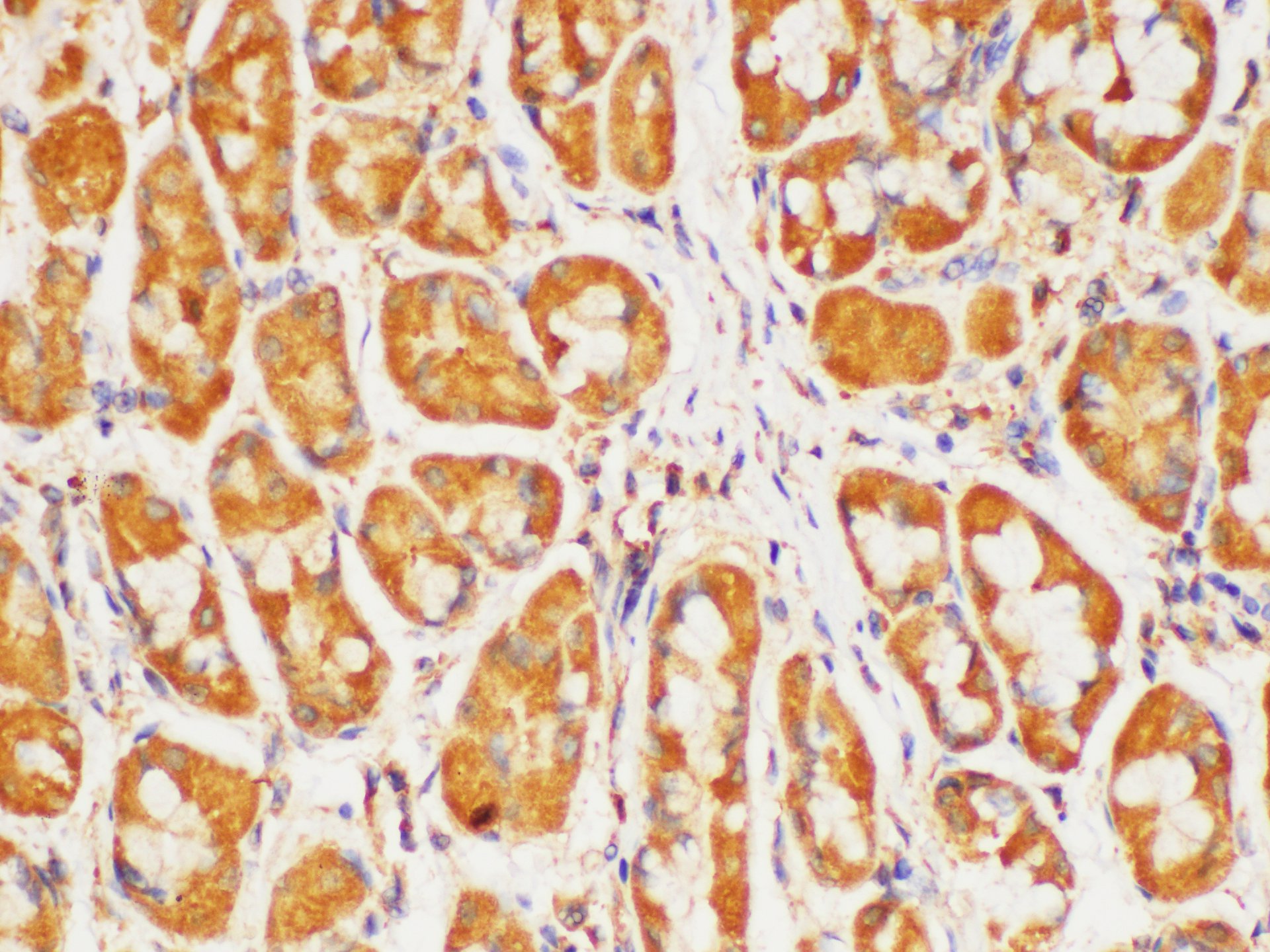 Immunohistochemistry of paraffin-embedded Human stomach using HRAS Polycloanl Antibody at dilution of 1:200