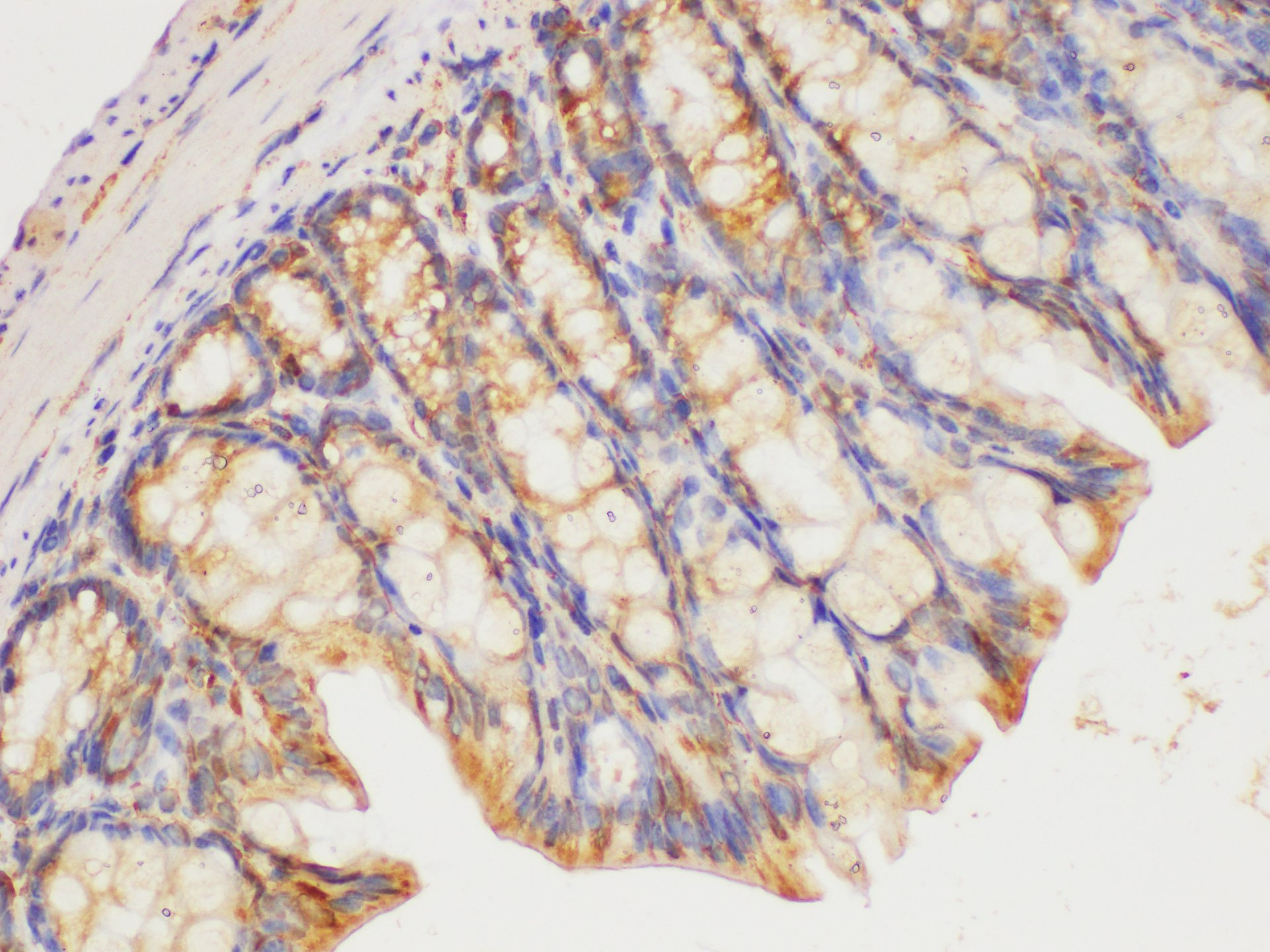 Immunohistochemistry of paraffin-embedded Mouse colon using HRAS Polycloanl Antibody at dilution of 1:200