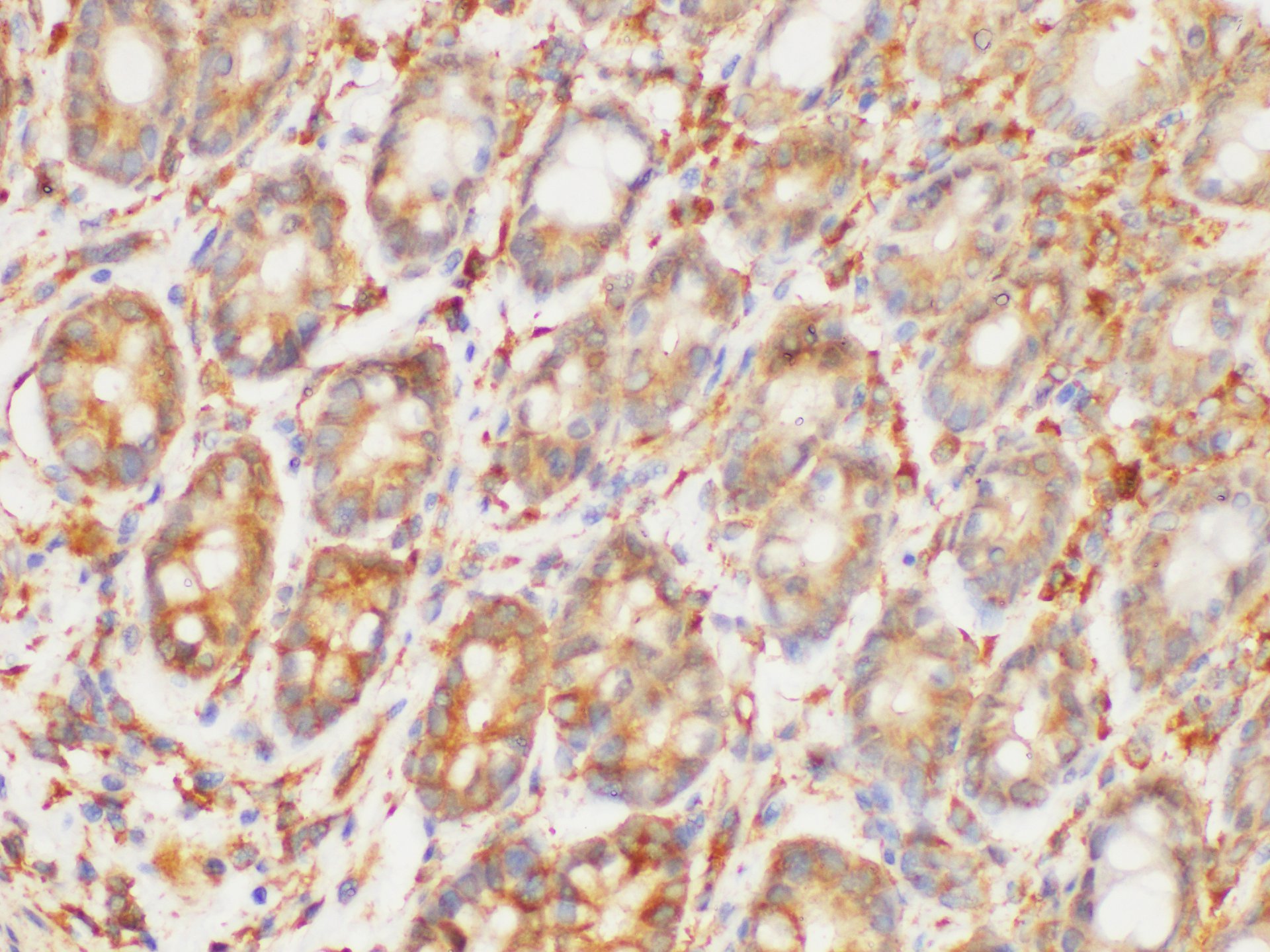 Immunohistochemistry of paraffin-embedded Rat colon using HRAS Polycloanl Antibody at dilution of 1:200