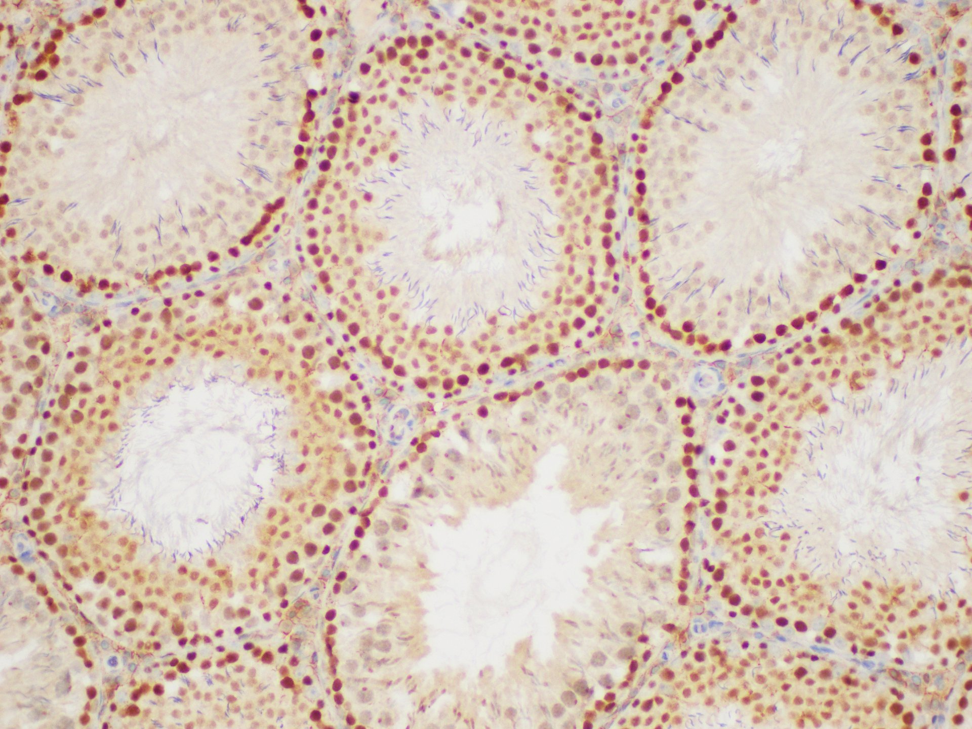 Immunohistochemistry of paraffin-embedded Rat testis using PCNA Polycloanl Antibody at dilution of 1:50