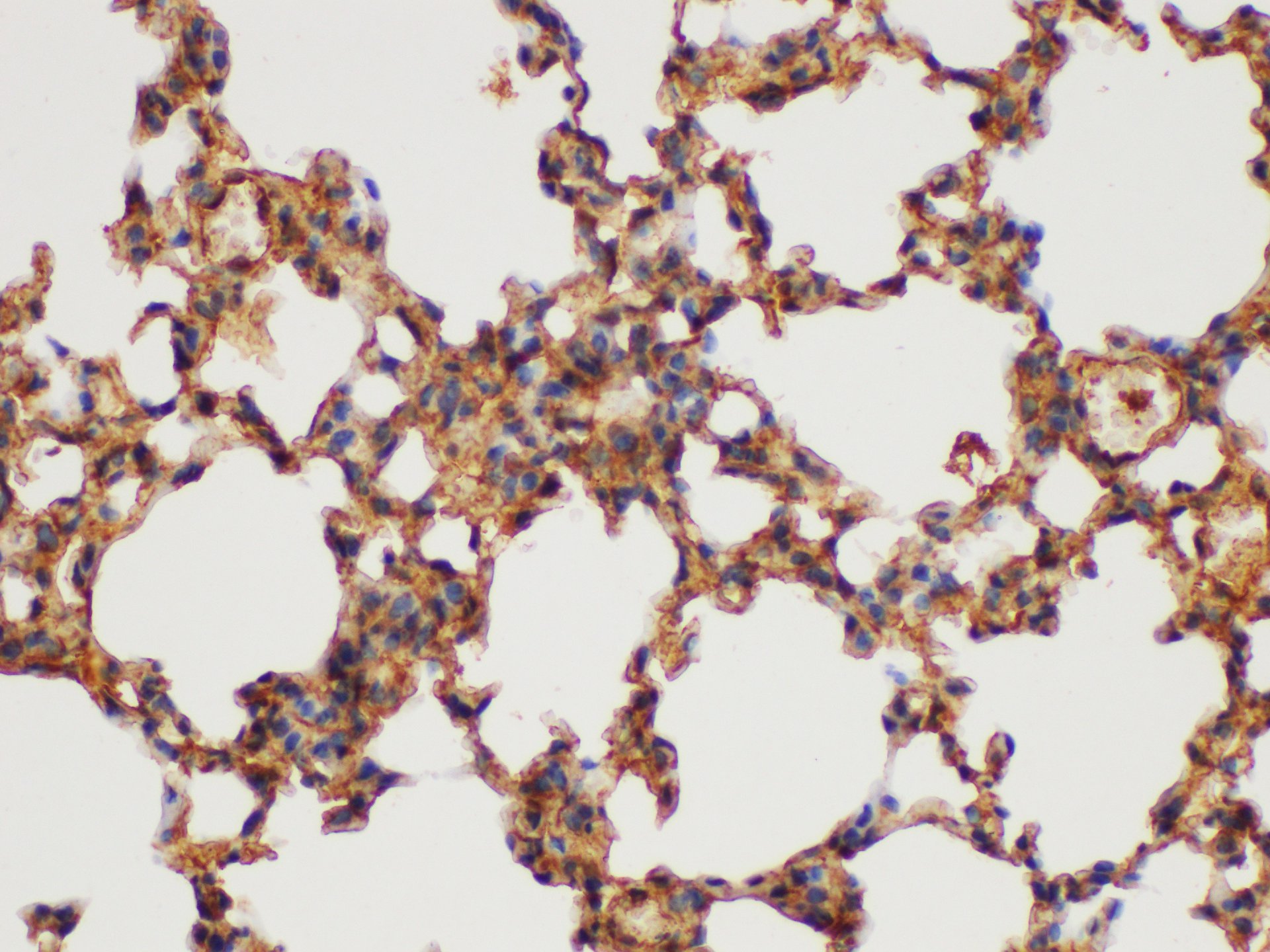 Immunohistochemistry of paraffin-embedded Mouse lung using GSTP1 Polycloanl Antibody at dilution of 1:100