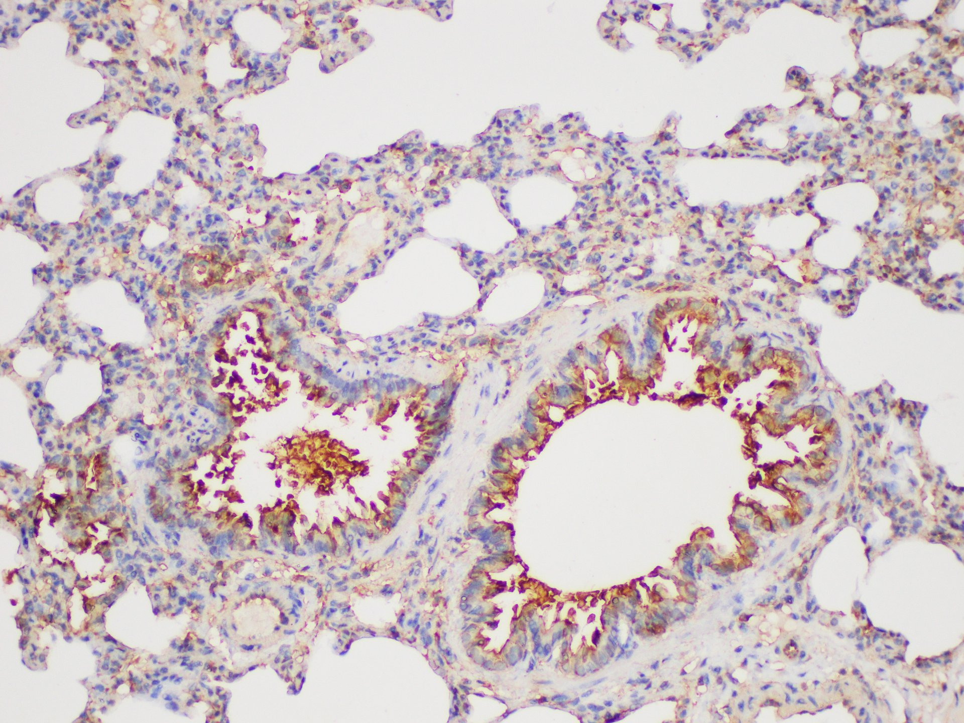 Immunohistochemistry of paraffin-embedded Rat lung using GSTP1 Polycloanl Antibody at dilution of 1:100