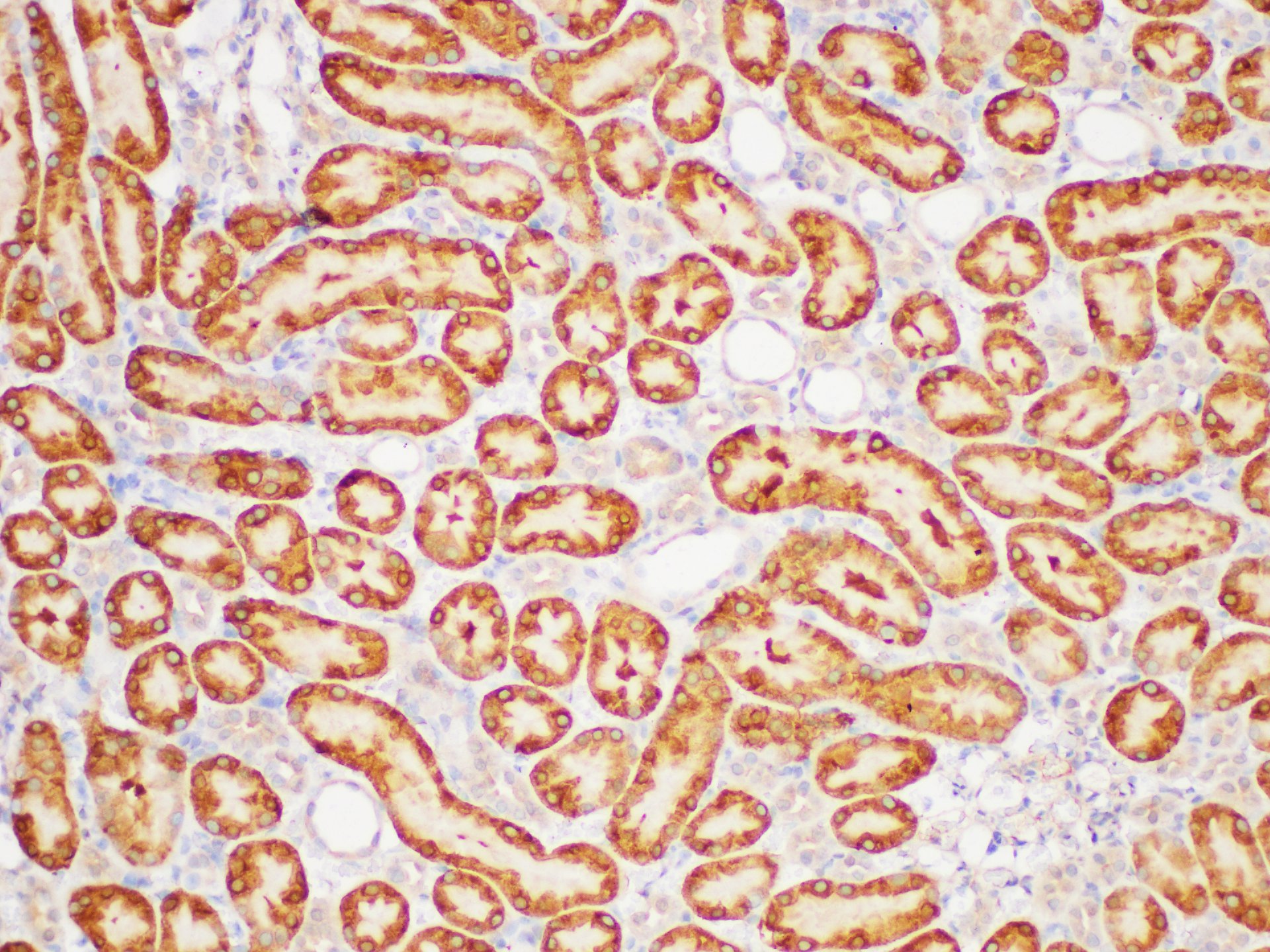 Immunohistochemistry of paraffin-embedded Rat kidney using GSTP1 Polycloanl Antibody at dilution of 1:100