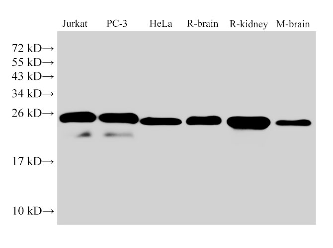 Western Blot analysis of Jurkat, PC-3, Hela, Rat brain, Rat kidney and Mouse brain using GSTP1 Polyclonal Antibody at dilution of 1:1000