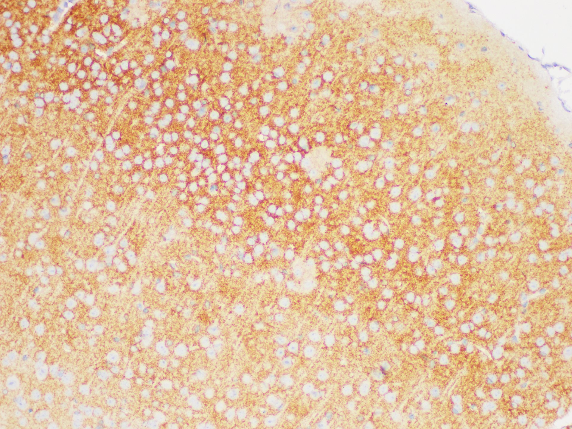 Immunohistochemistry of paraffin-embedded Mouse brain using TGFBR1 Polycloanl Antibody at dilution of 1:200