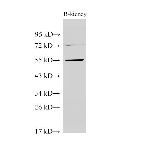 Western Blot analysis of Rat kidney using TGFBR1 Polyclonal Antibody at dilution of 1:1000