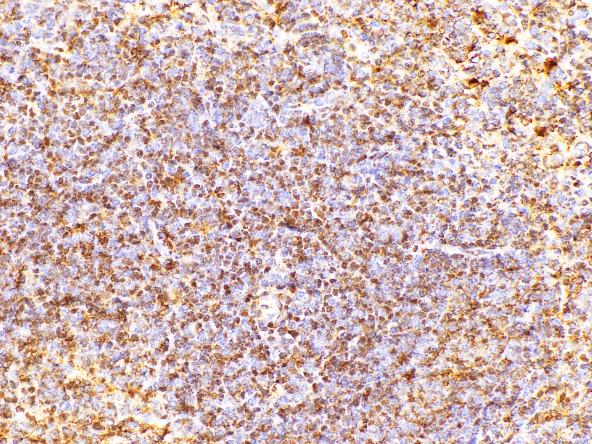 Immunohistochemistry of paraffin-embedded Mouse spleen using CD38 Polycloanl Antibody at dilution of 1:200