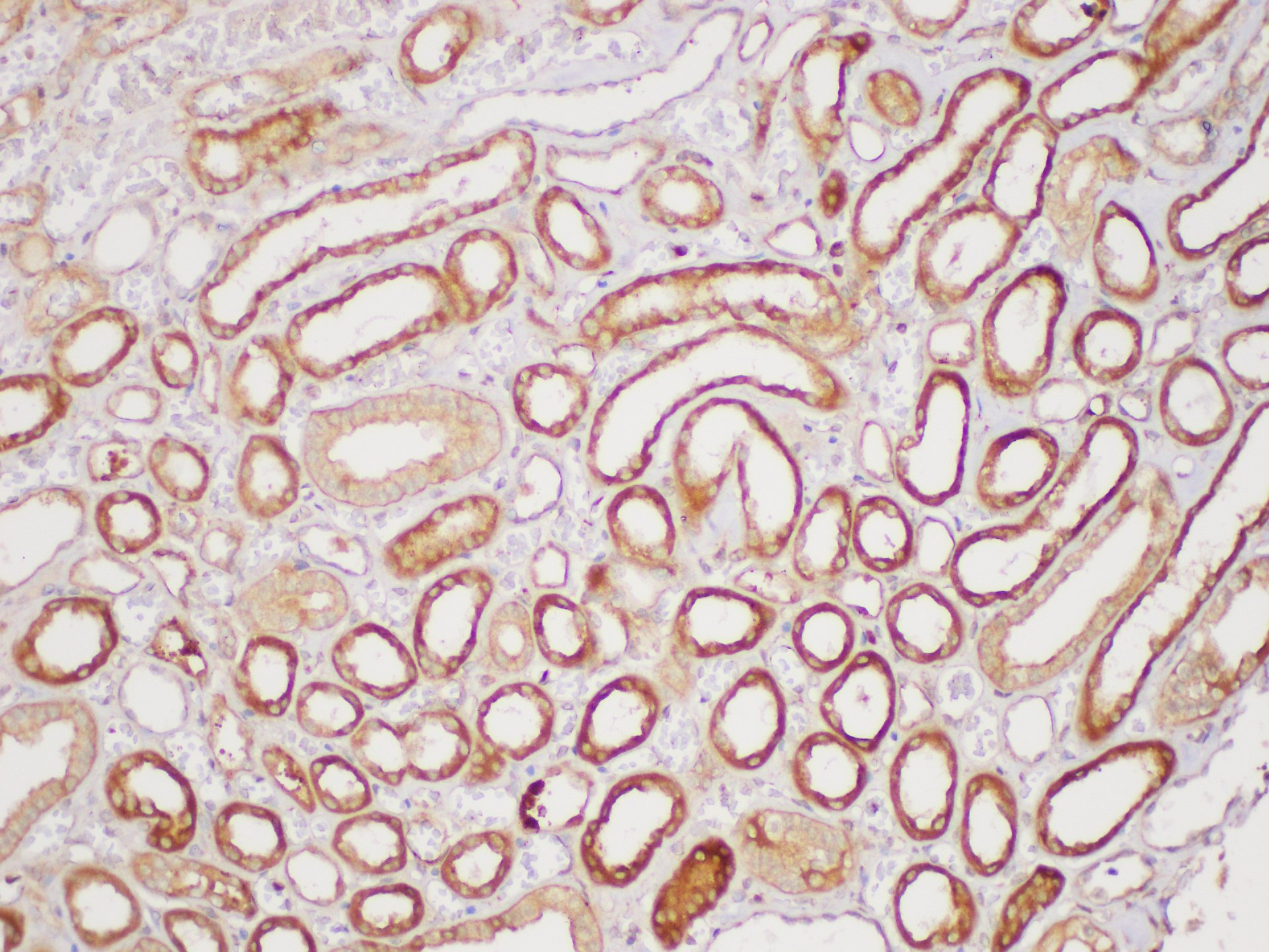 Immunohistochemistry of paraffin-embedded Human kidney using SERPINB2 Polycloanl Antibody at dilution of 1:200