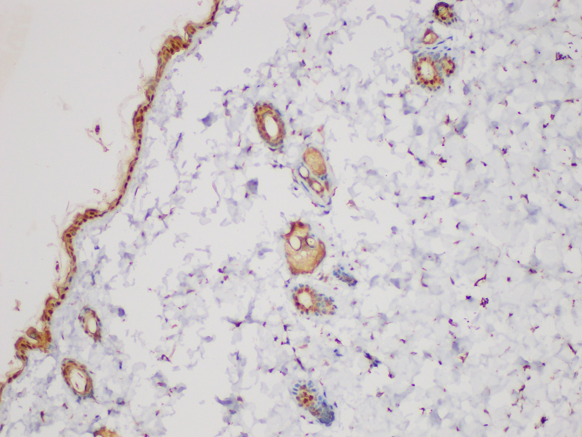 Immunohistochemistry of paraffin-embedded Mouse skin using SERPINB2 Polycloanl Antibody at dilution of 1:200