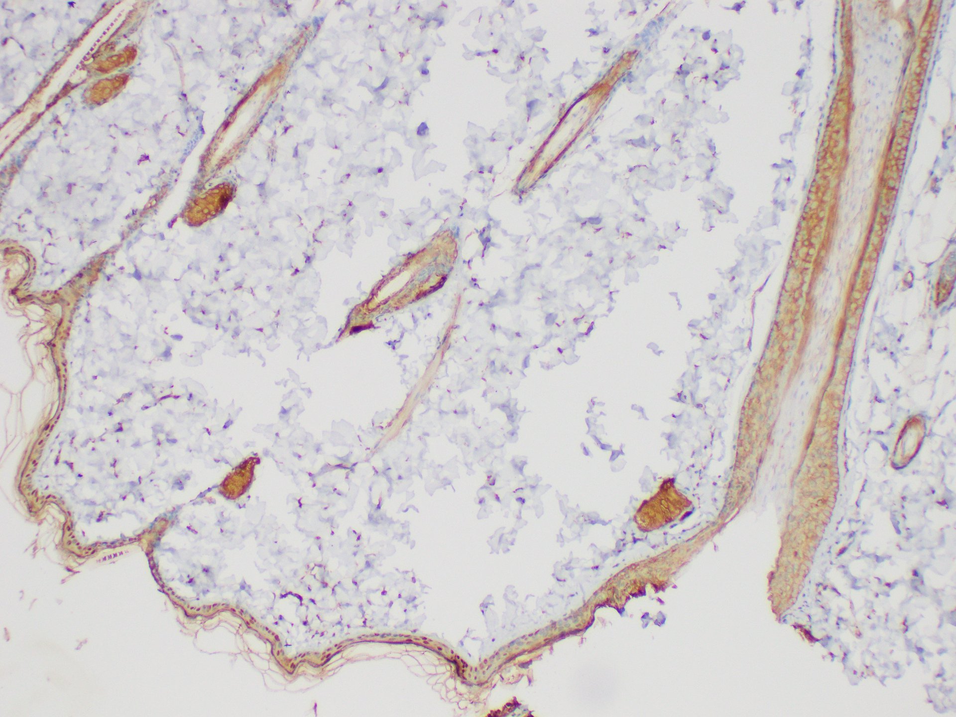 Immunohistochemistry of paraffin-embedded Rat skin using SERPINB2 Polycloanl Antibody at dilution of 1:200