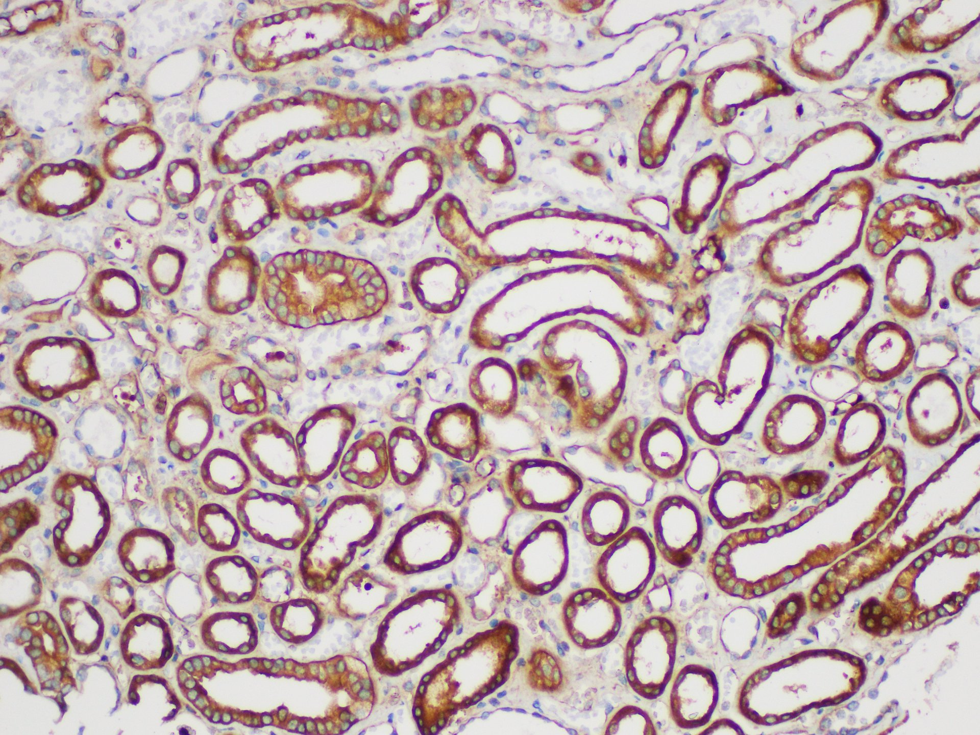 Immunohistochemistry of paraffin-embedded Human kidney using SERPINB2 Polycloanl Antibody at dilution of 1:200