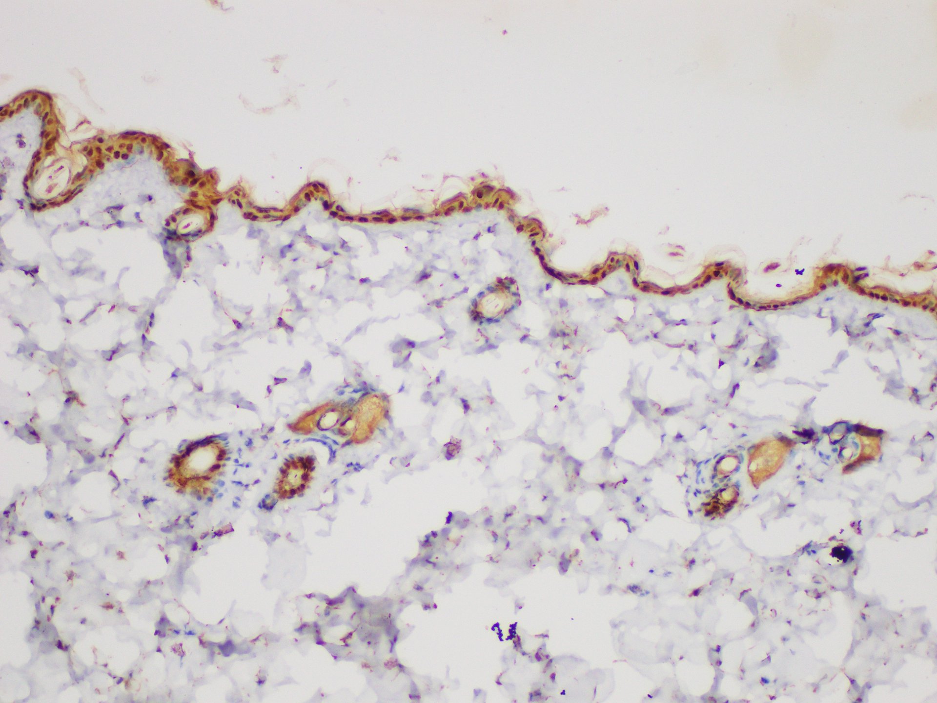 Immunohistochemistry of paraffin-embedded Mouse skin using SERPINB2 Polycloanl Antibody at dilution of 1:200