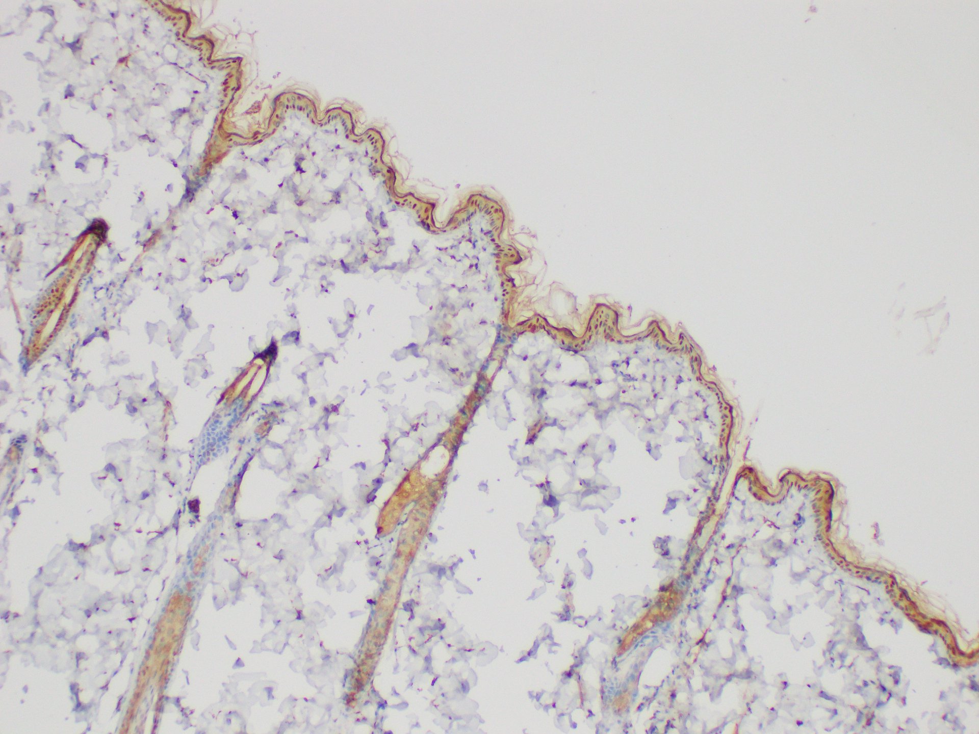 Immunohistochemistry of paraffin-embedded Rat skin using SERPINB2 Polycloanl Antibody at dilution of 1:200