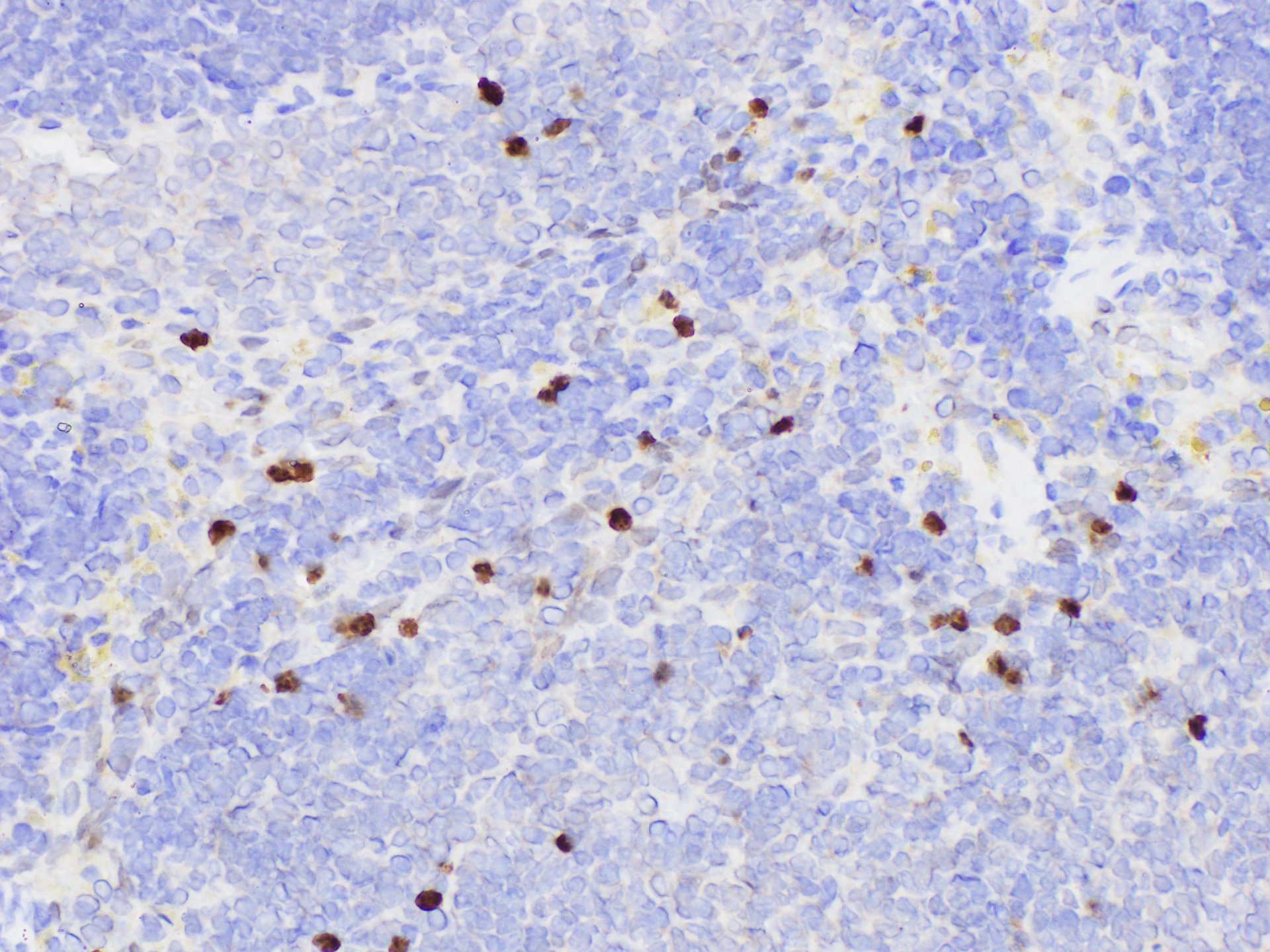 Immunohistochemistry of paraffin-embedded Rat spleen using SERPINB2 Polycloanl Antibody at dilution of 1:200